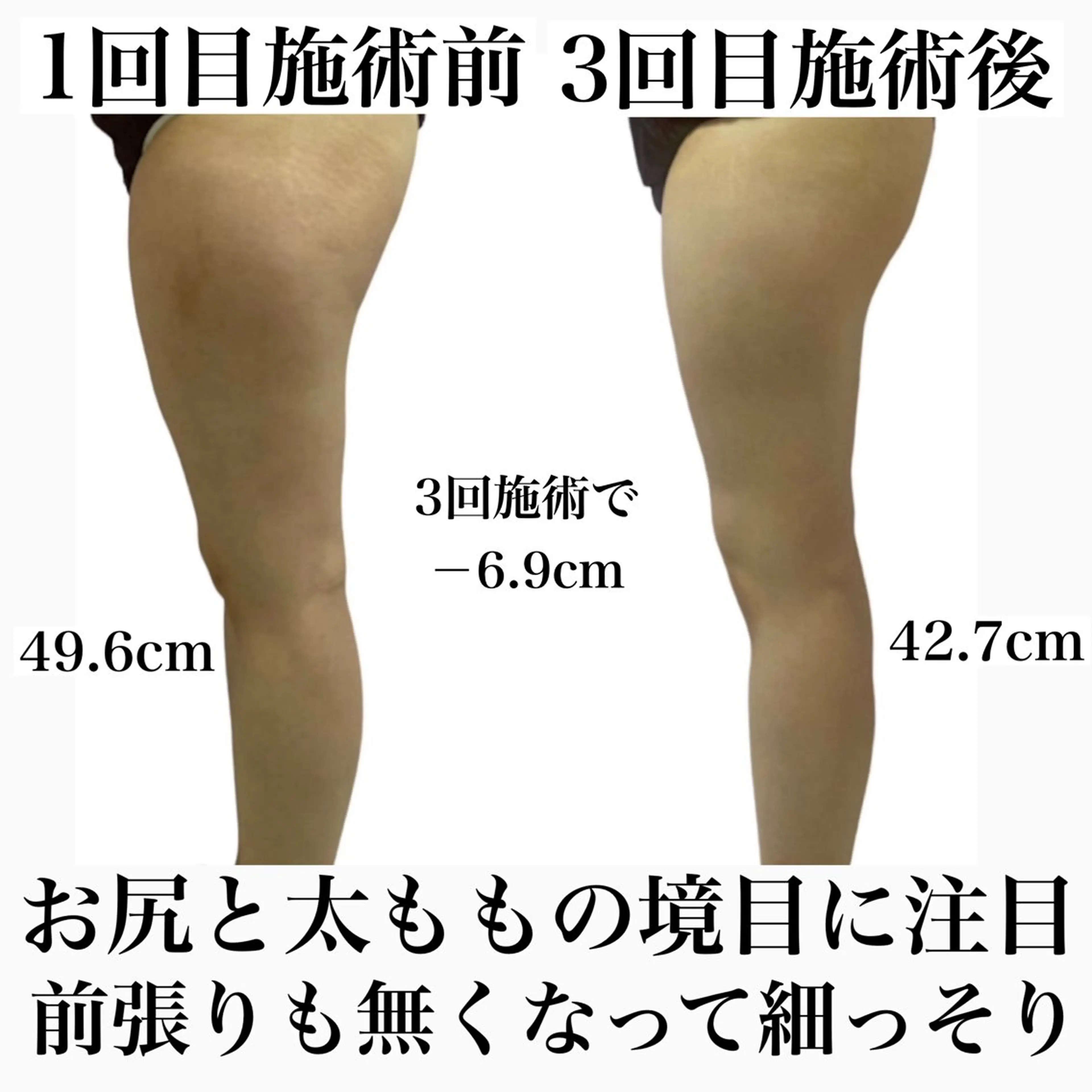 エステ Body Salon_Jのエステ・リラクイメージ