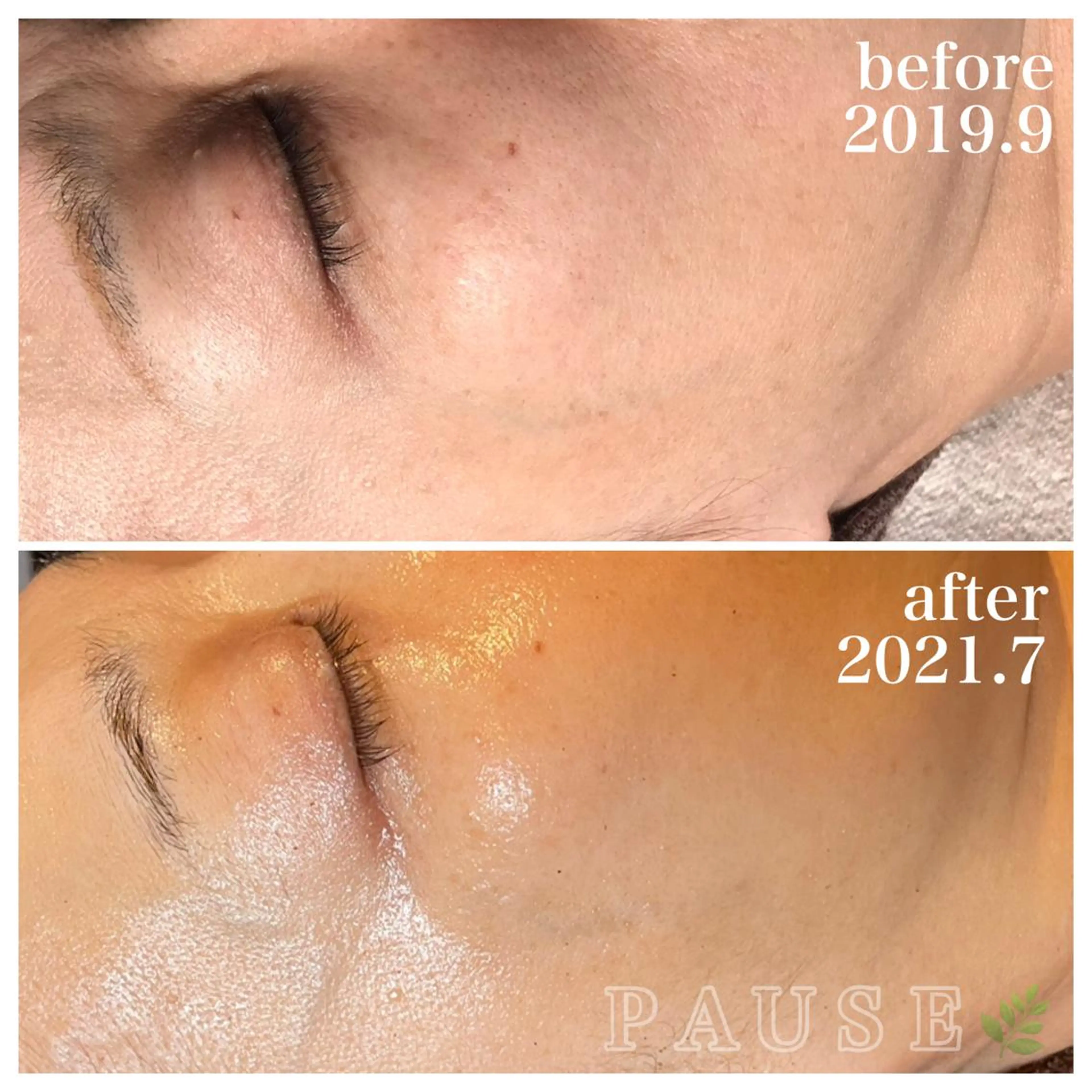 エステ 浜野 恵美のエステ・リラクイメージ