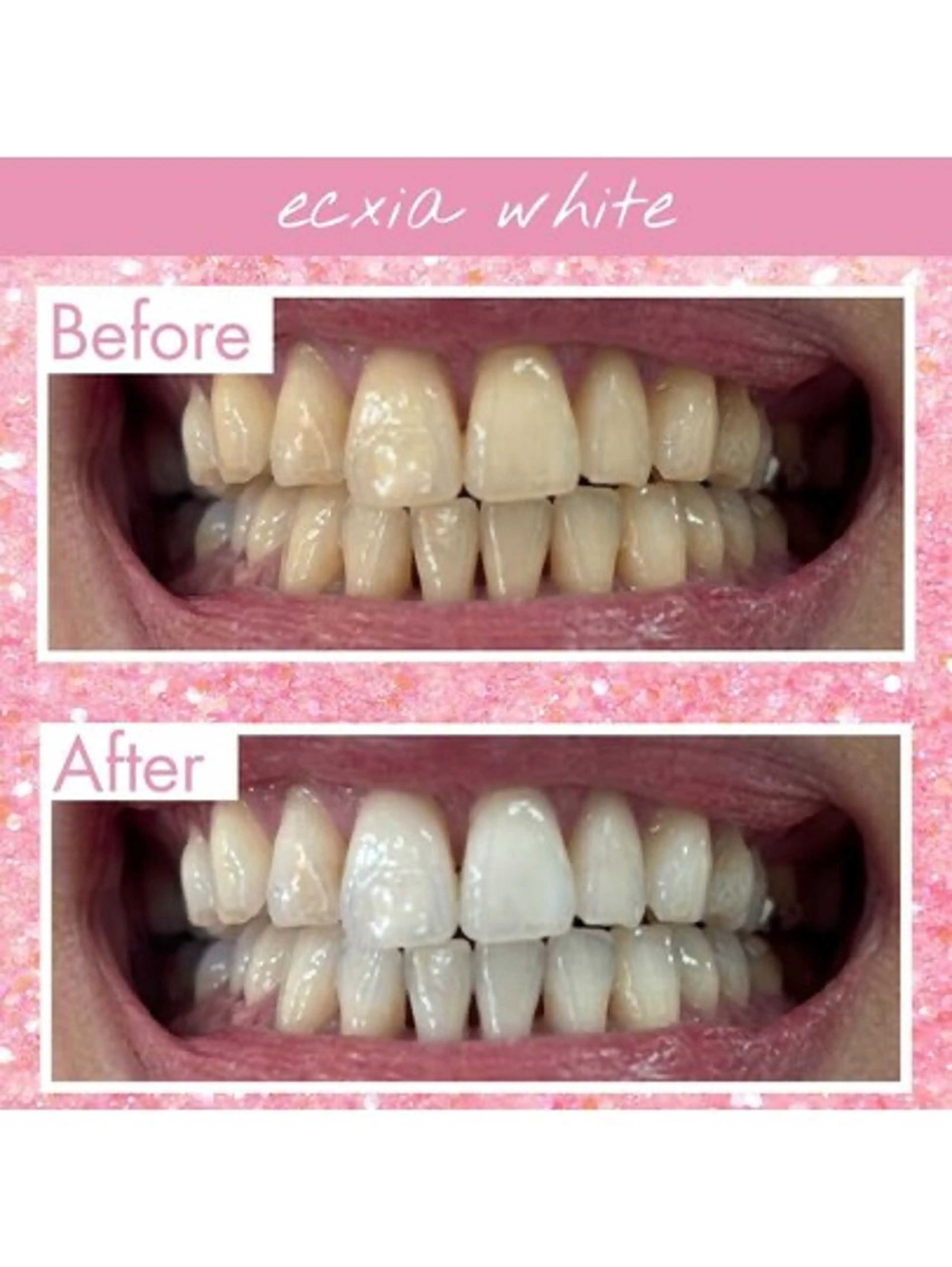 エクシア ホワイトニング西条店のその他イメージ