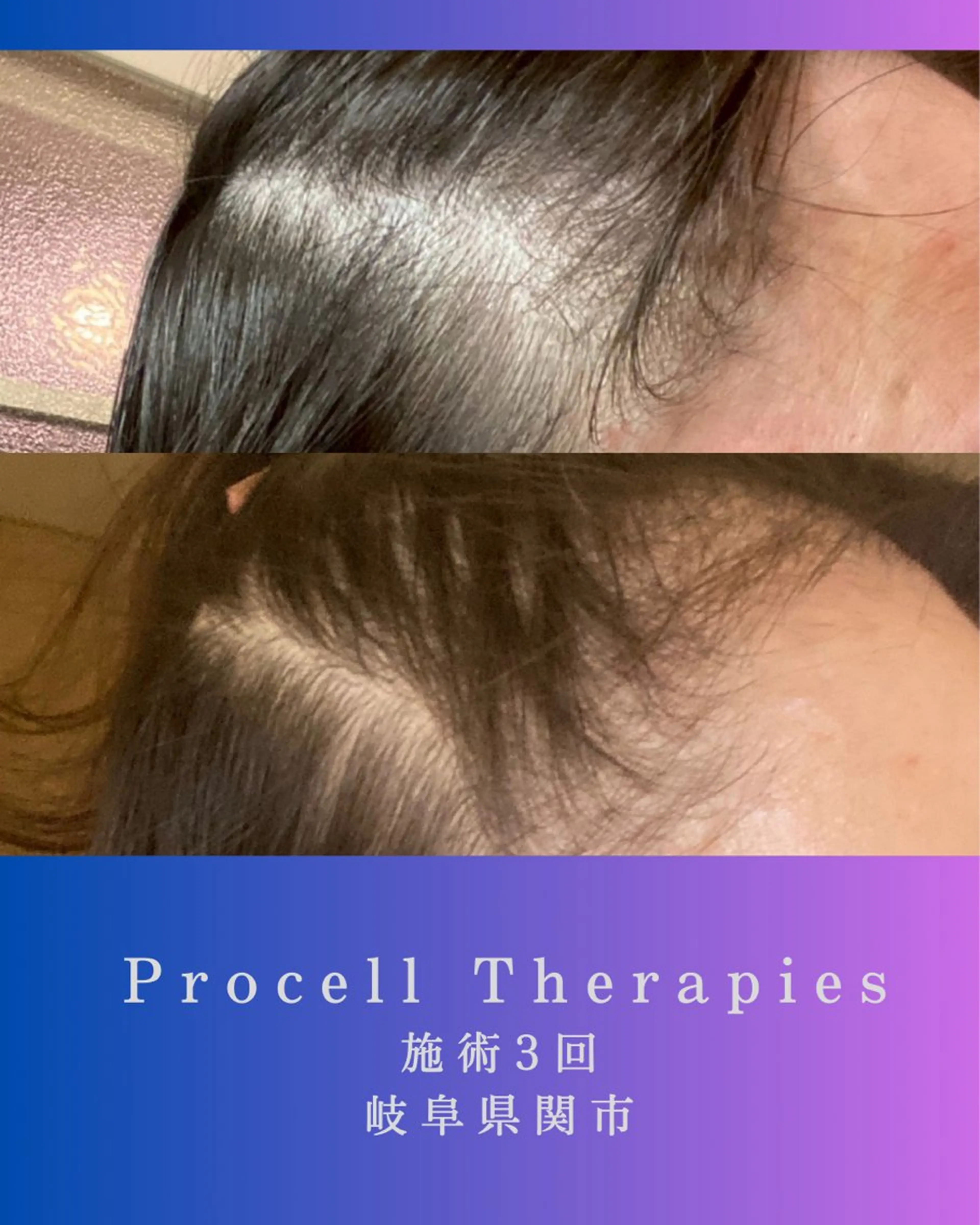 その他 氣楽所属・松下 さゆりのエステ・リラクイメージ