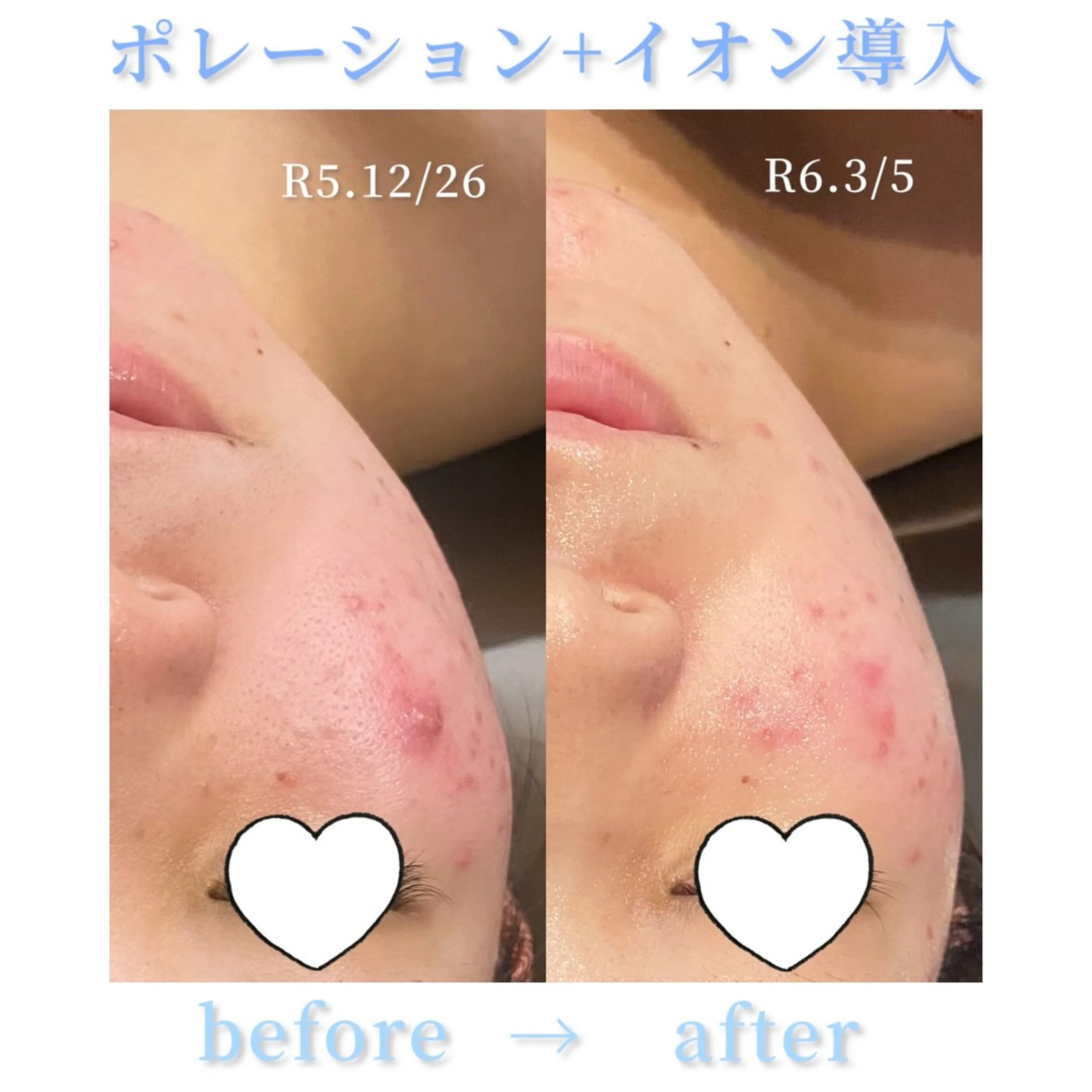 エステ 【Folche 春日店】馬場のエステ・リラクイメージ