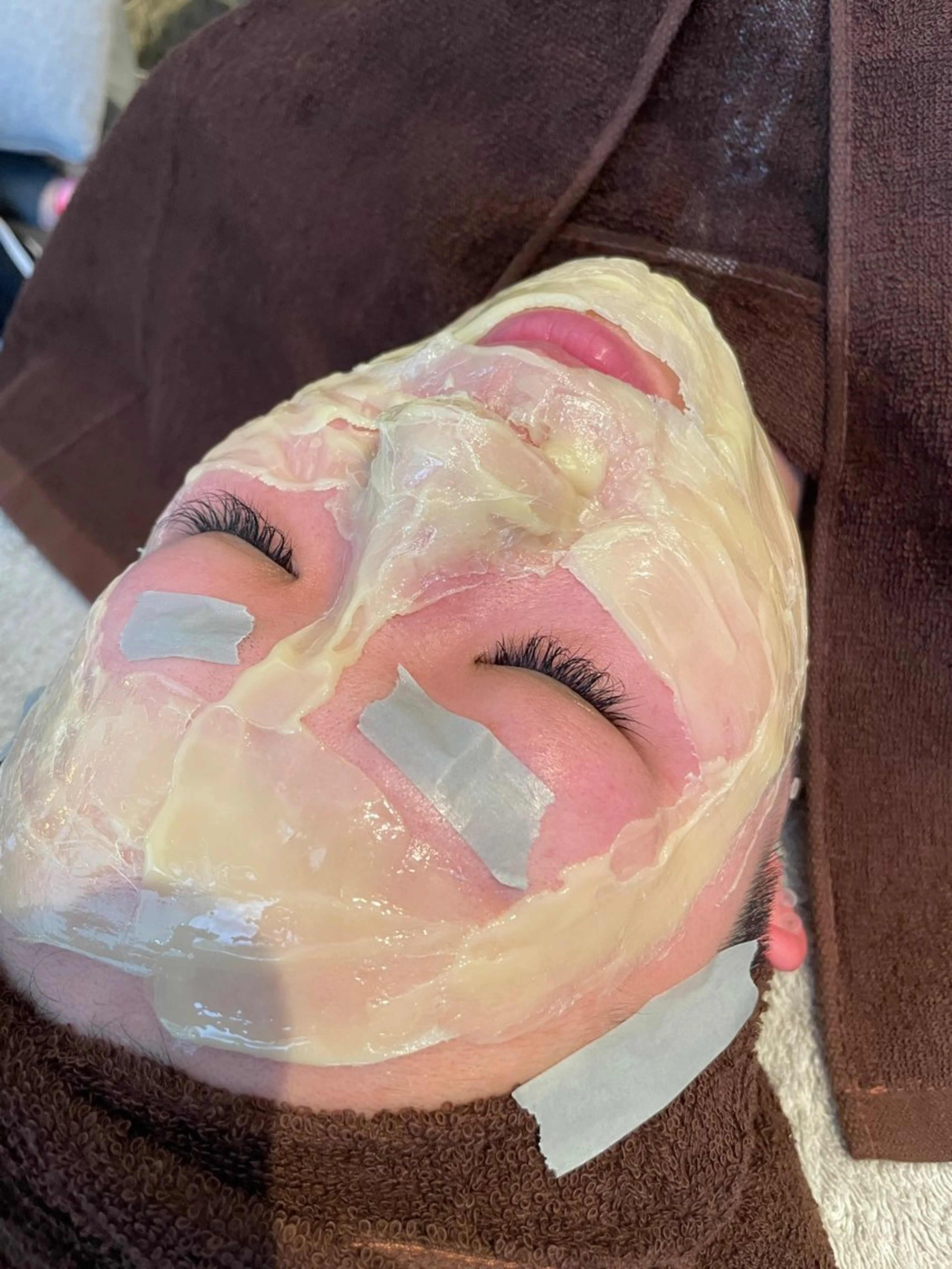 【ご新規様🉐】マツヤニパック全顔コース🍯つるんとゆで卵肌に✨️産毛、お口周りなど濃い毛を徹底的に除去🔥の写真