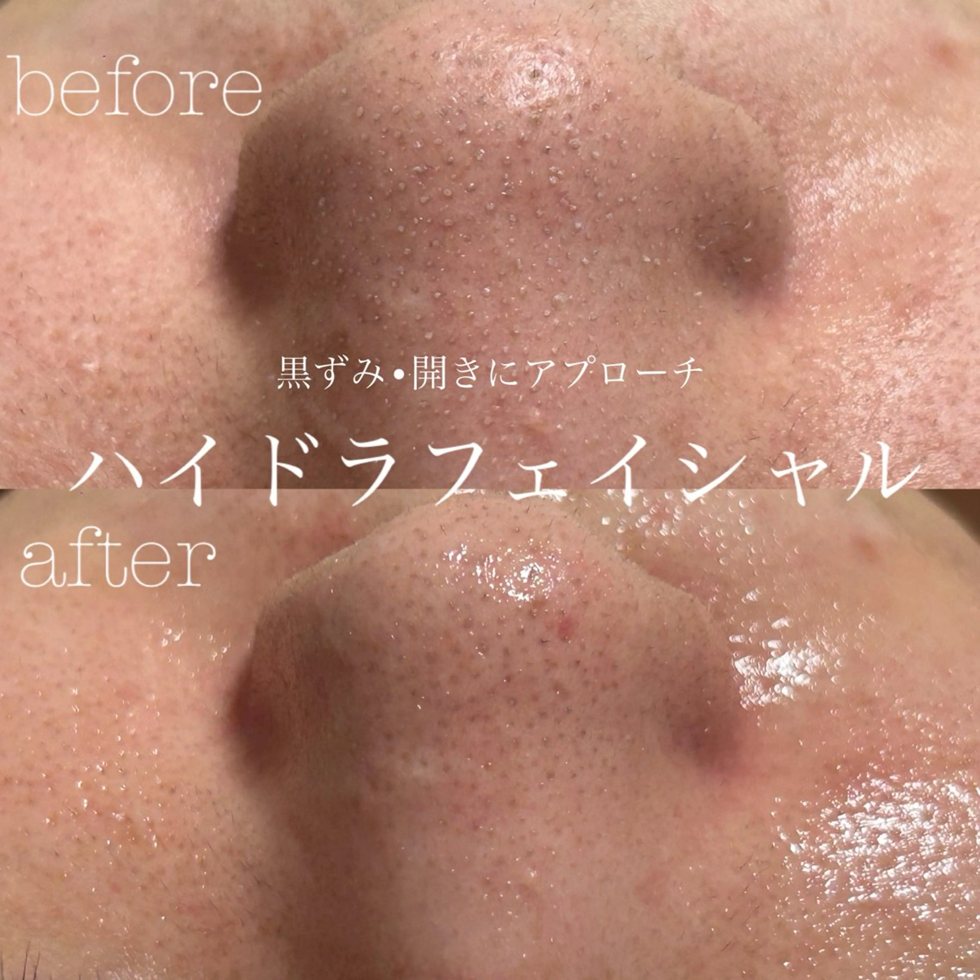 エステ フェイシャルサロン CHIARA 荒田のエステ・リラクイメージ