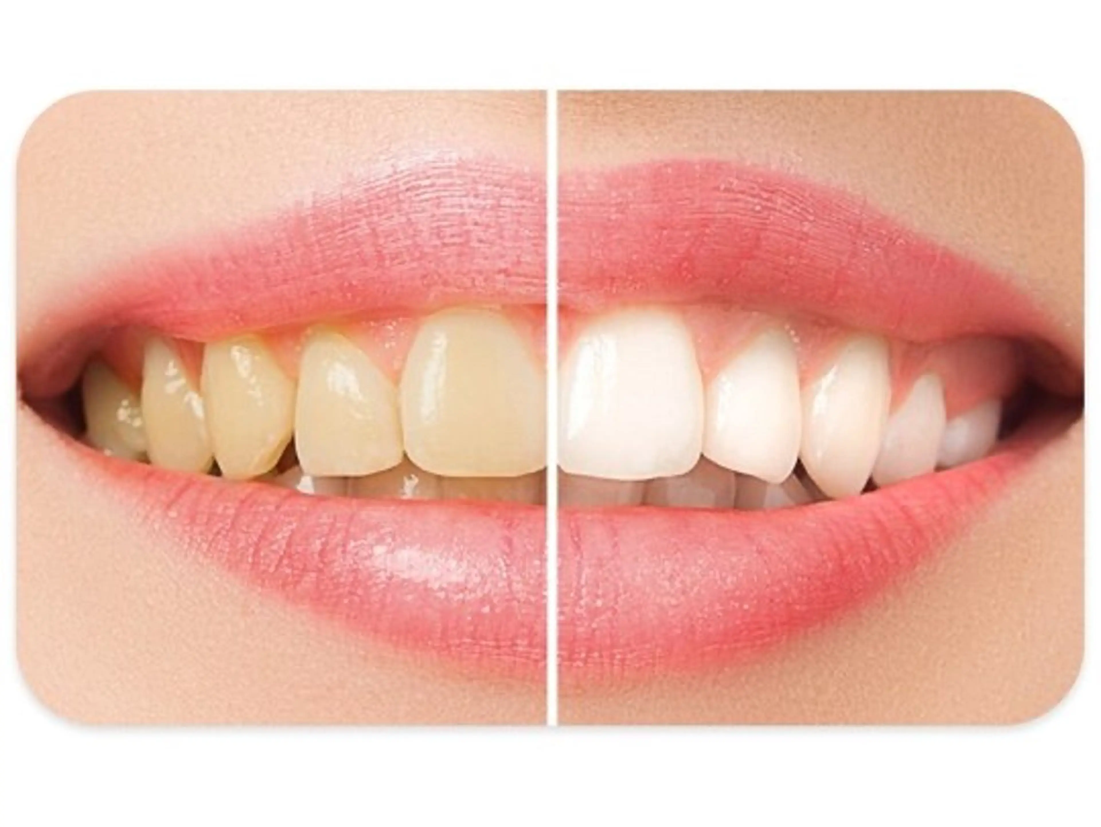 エクシア ホワイトニング西条店のその他イメージ