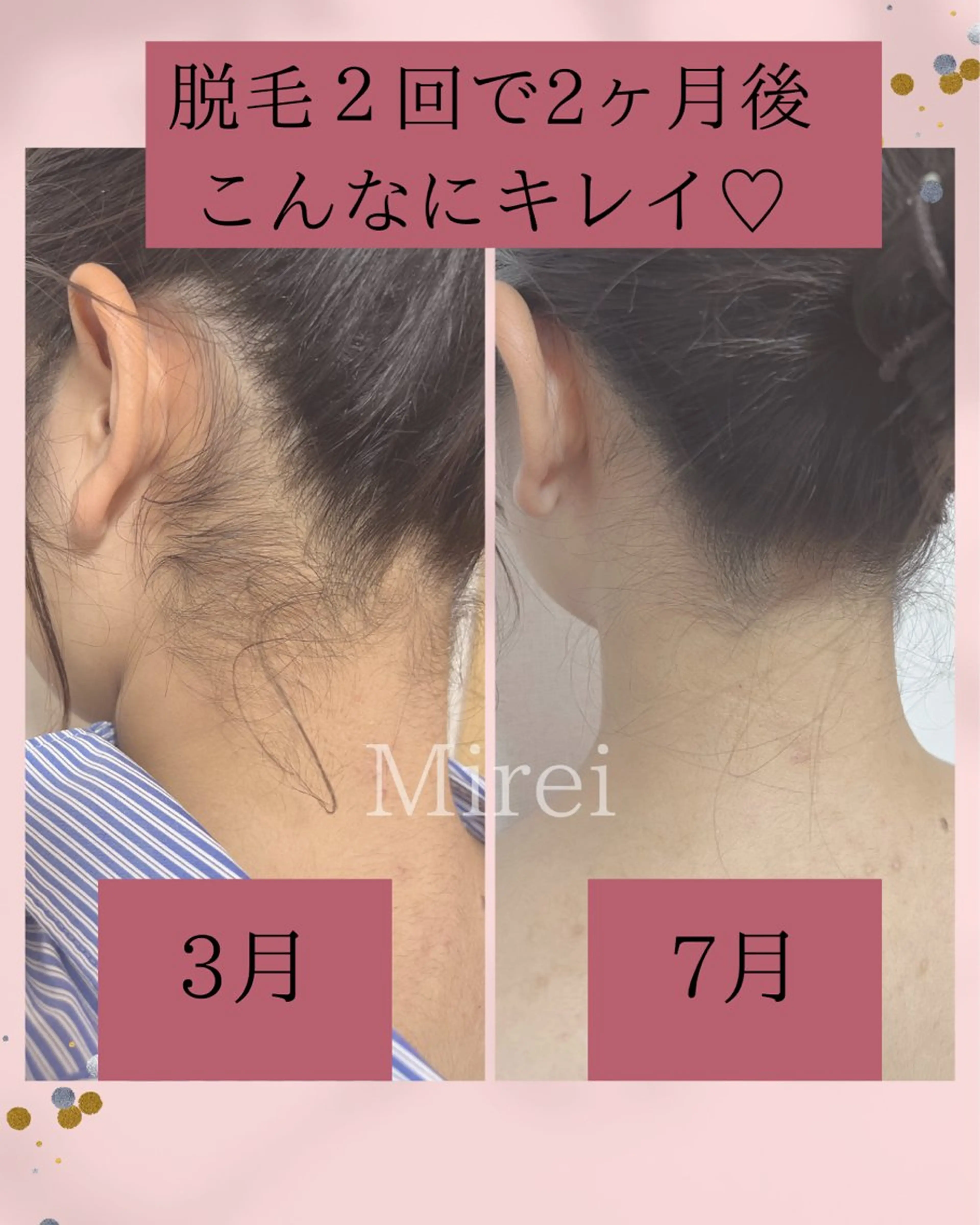 フェムケアサロン MIREIのその他イメージ