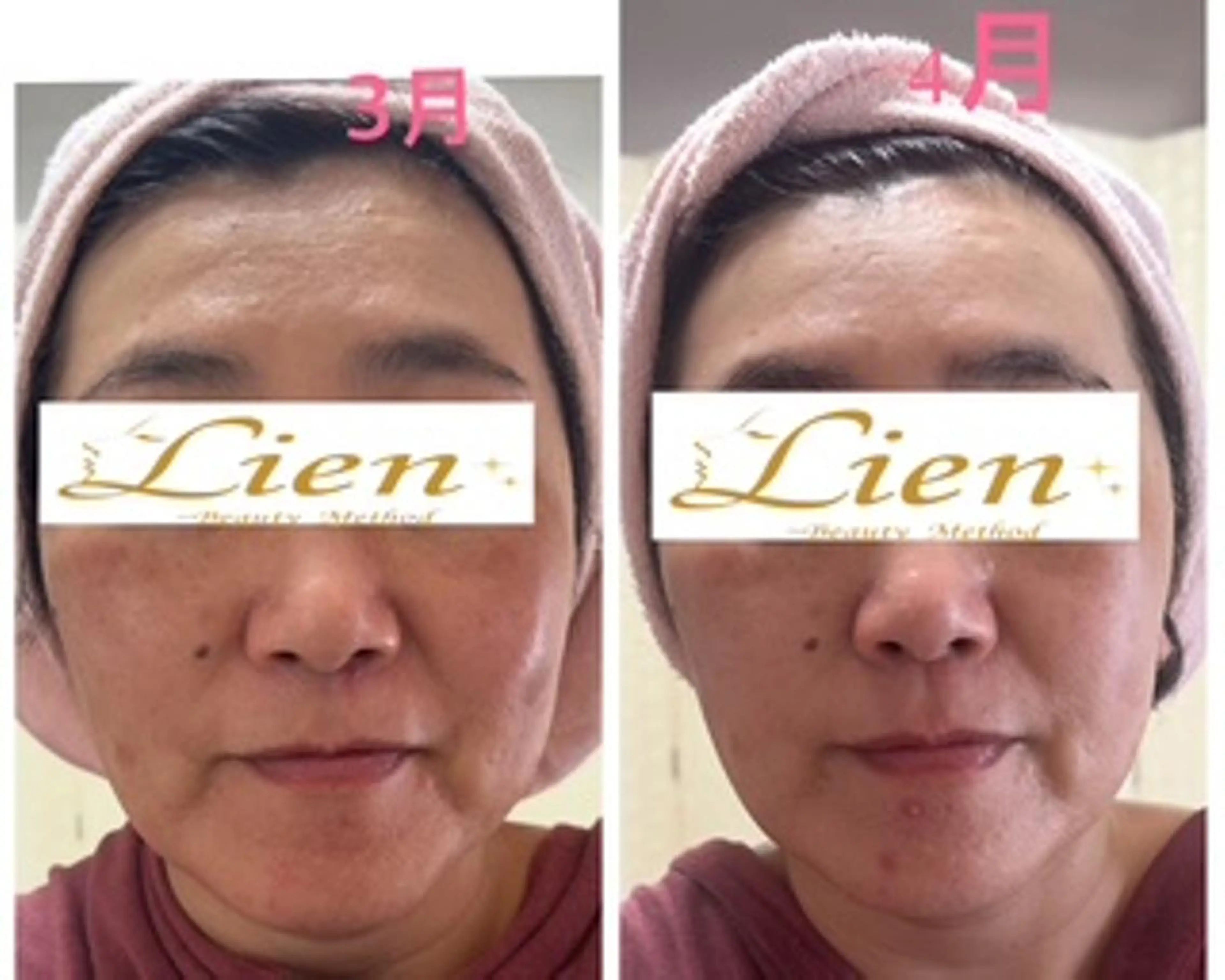Lien オーナー　山口智嘉のエステ・リラクイメージ
