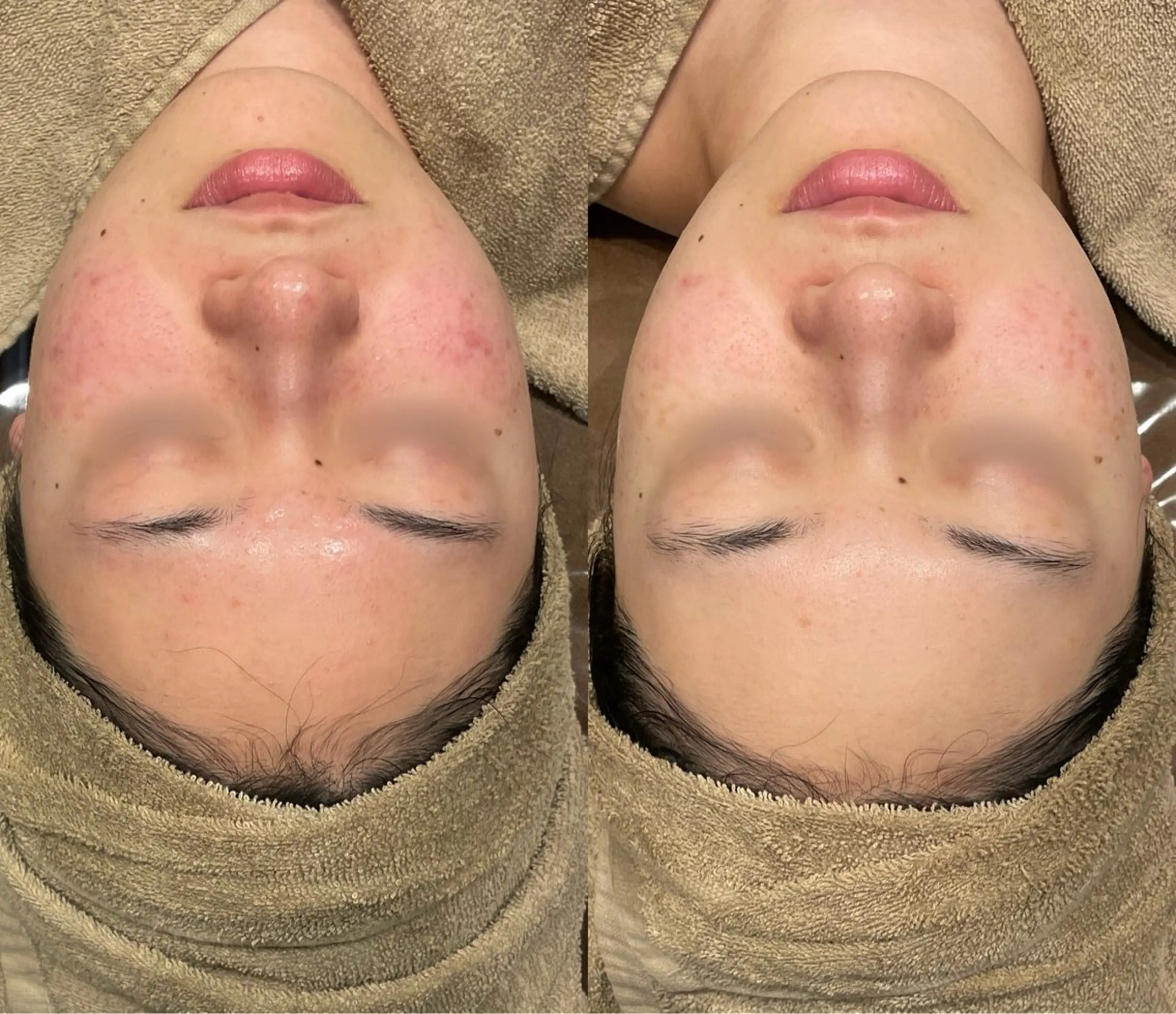 エステ Re:Belle所属・Re:Belle 久留米 : 中島のエステ・リラクイメージ