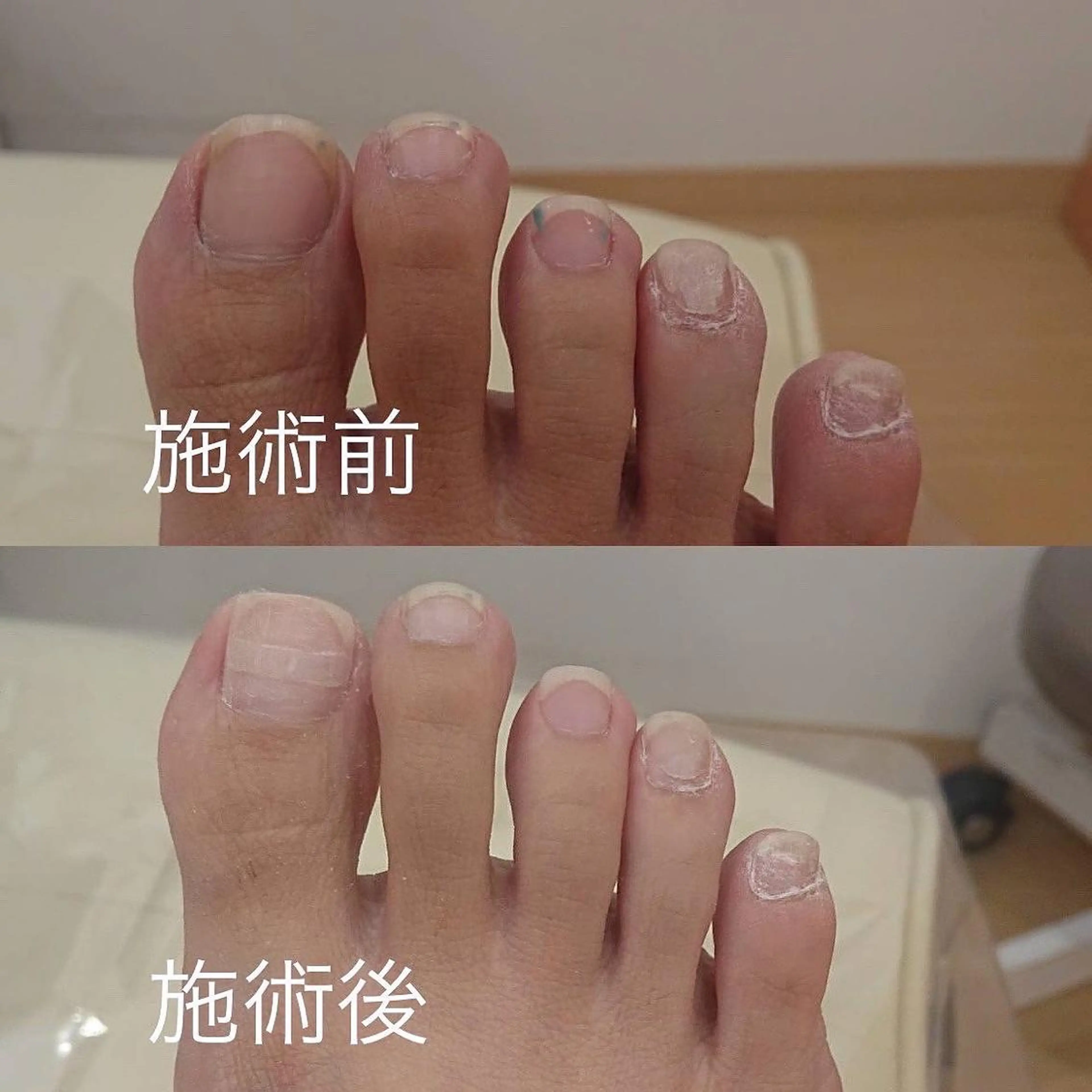 ケセラ ネイルケアのエステ・リラクイメージ