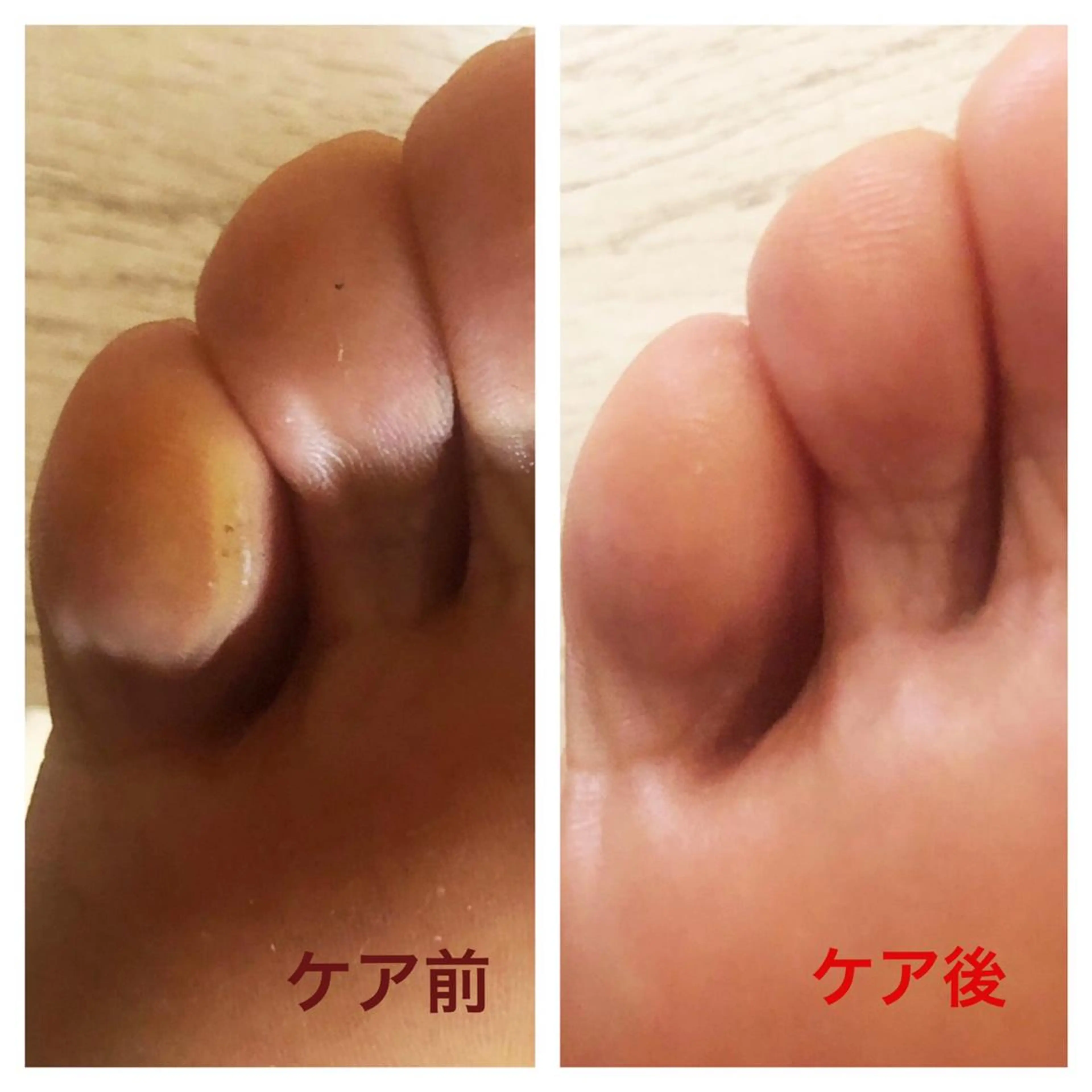 ショート ネイル フットネイル 🌱 ま　し　お　🌱のエステ・リラクイメージ