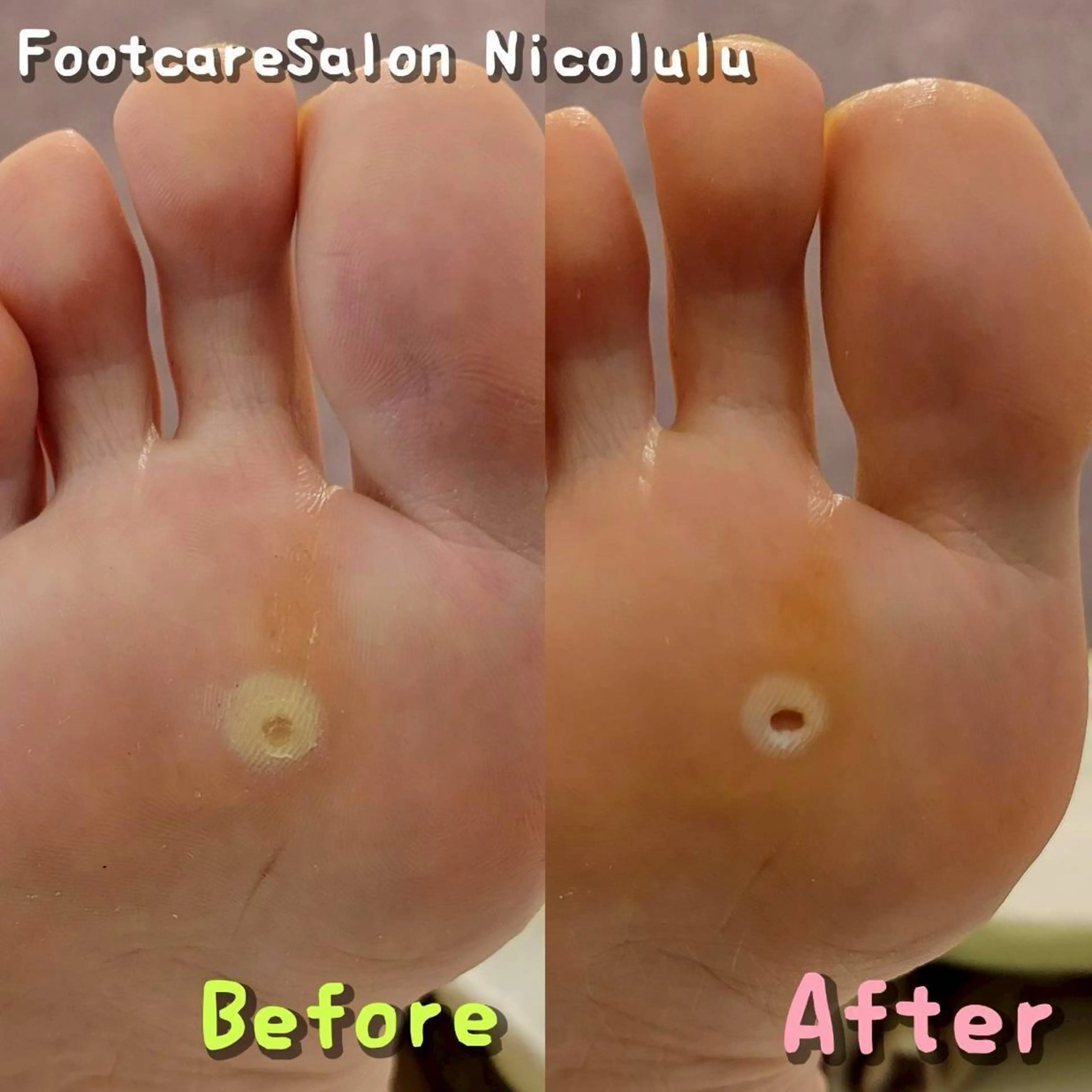 メンズ リラク 足トラブル専門 ニコルル金沢のエステ・リラクイメージ