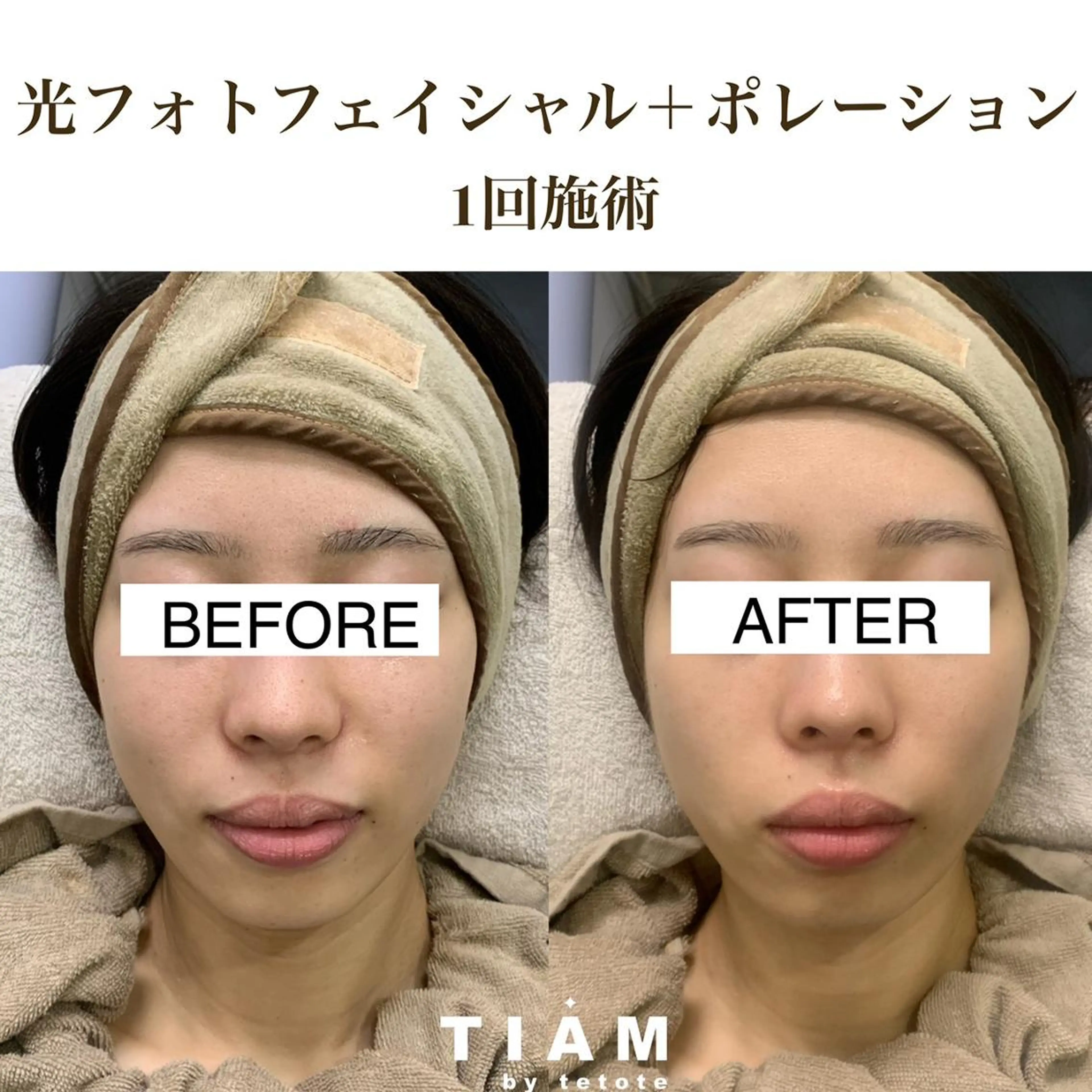 美肌サロンTIAM by tetoteのエステ・リラクイメージ