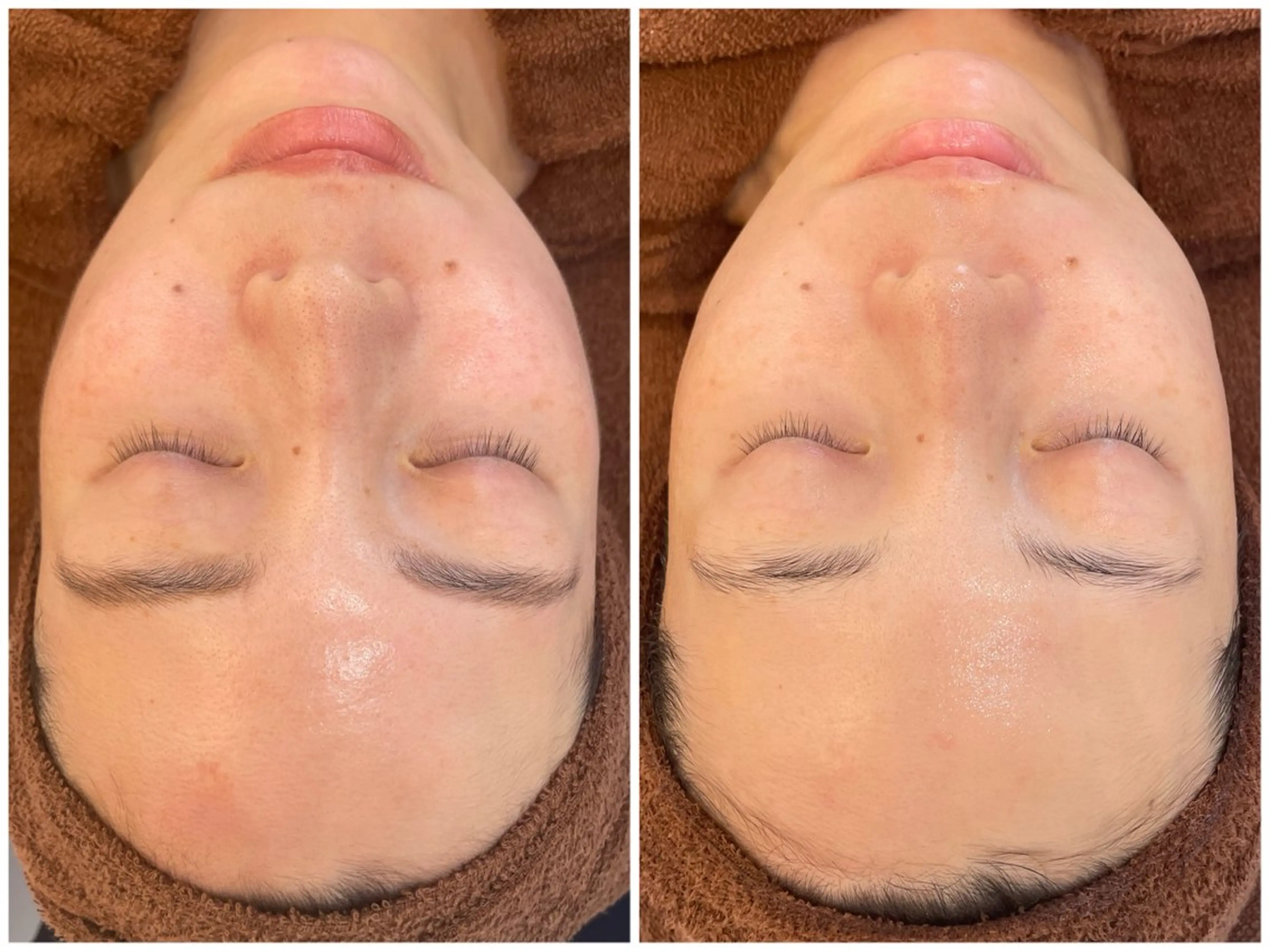 エステ リラク パーソナルスキンケア 🦋APRI🅿️有のエステ・リラクイメージ