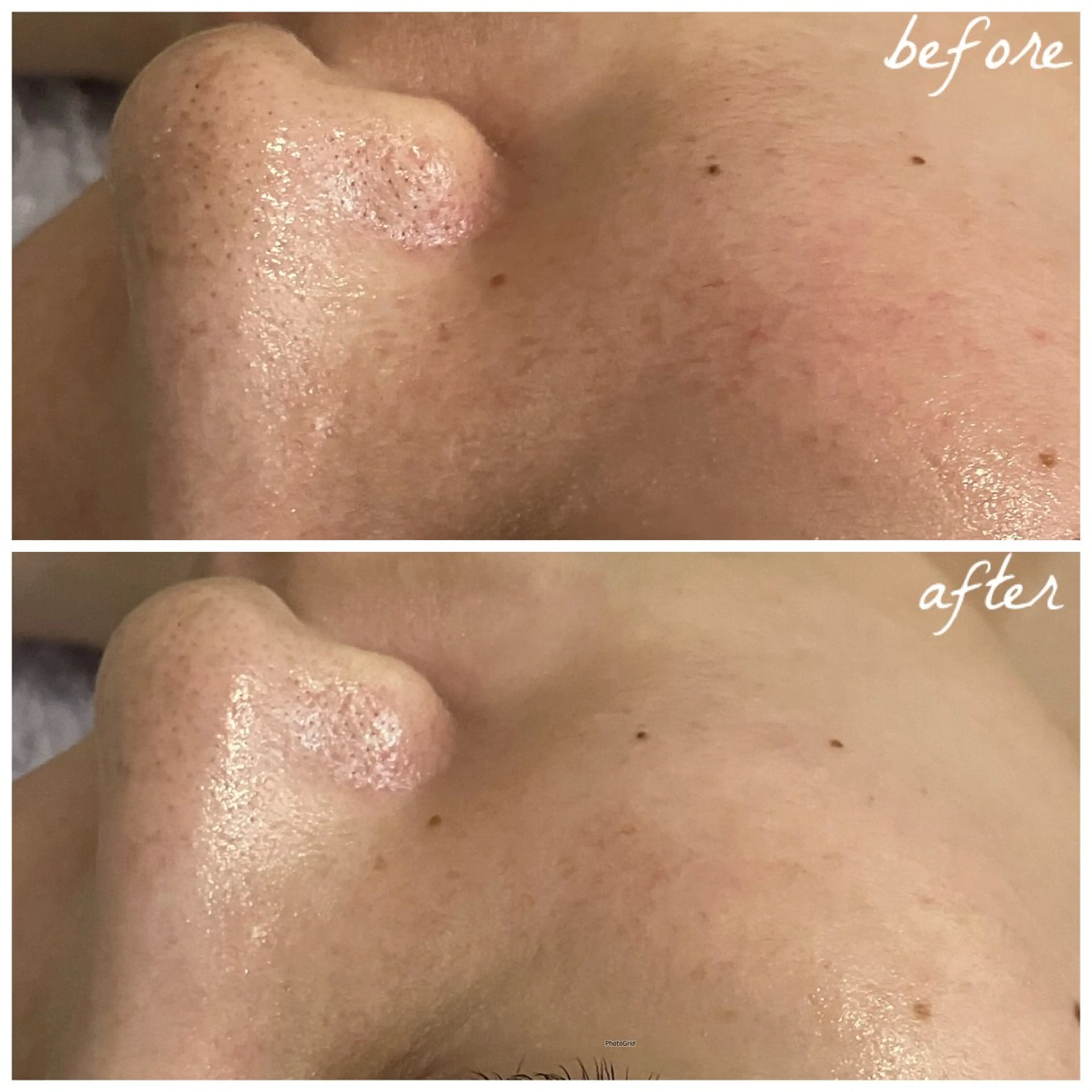 メンズ メナード岐阜茜部 杉浦のエステ・リラクイメージ