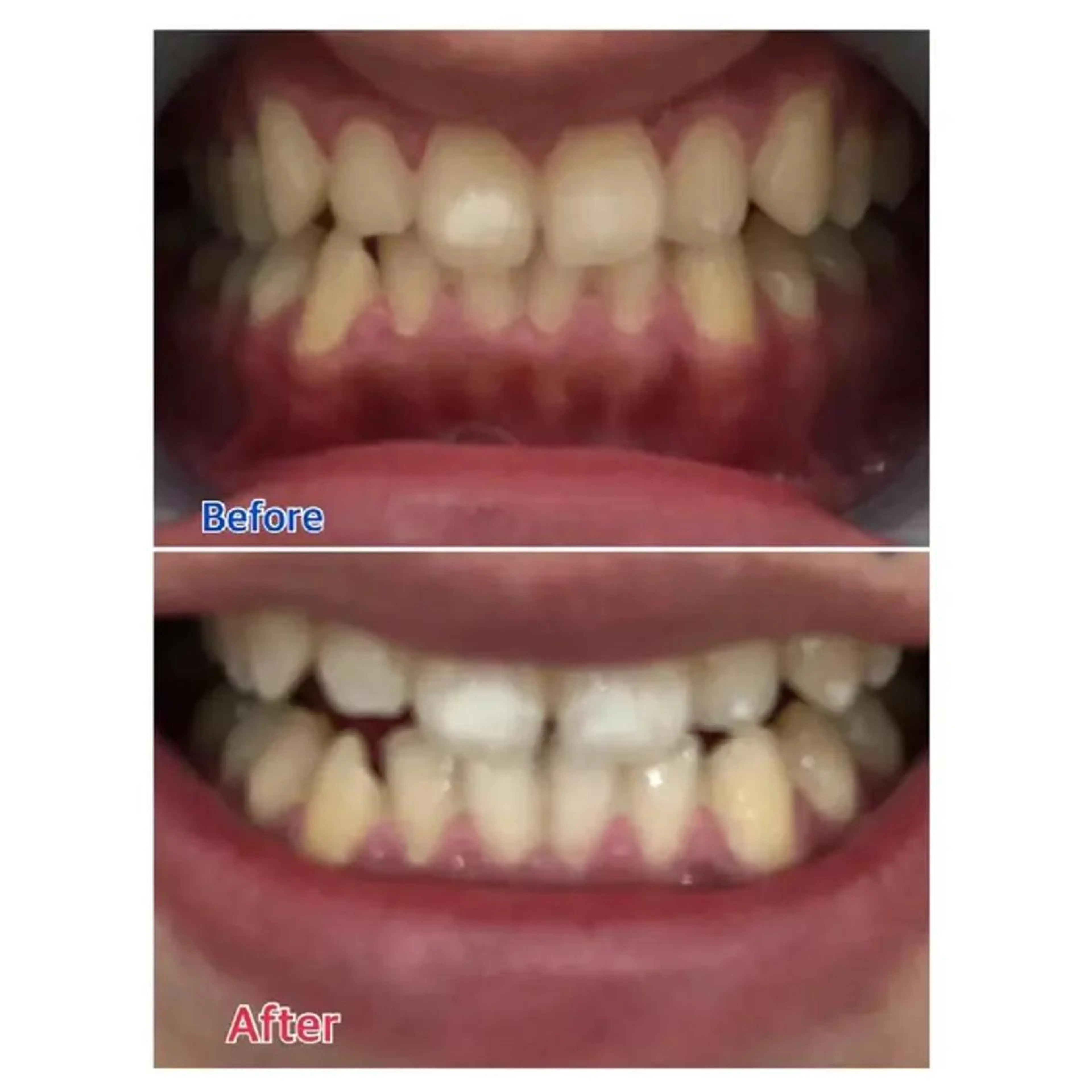 M渋谷 ホワイトニングのエステ・リラクイメージ