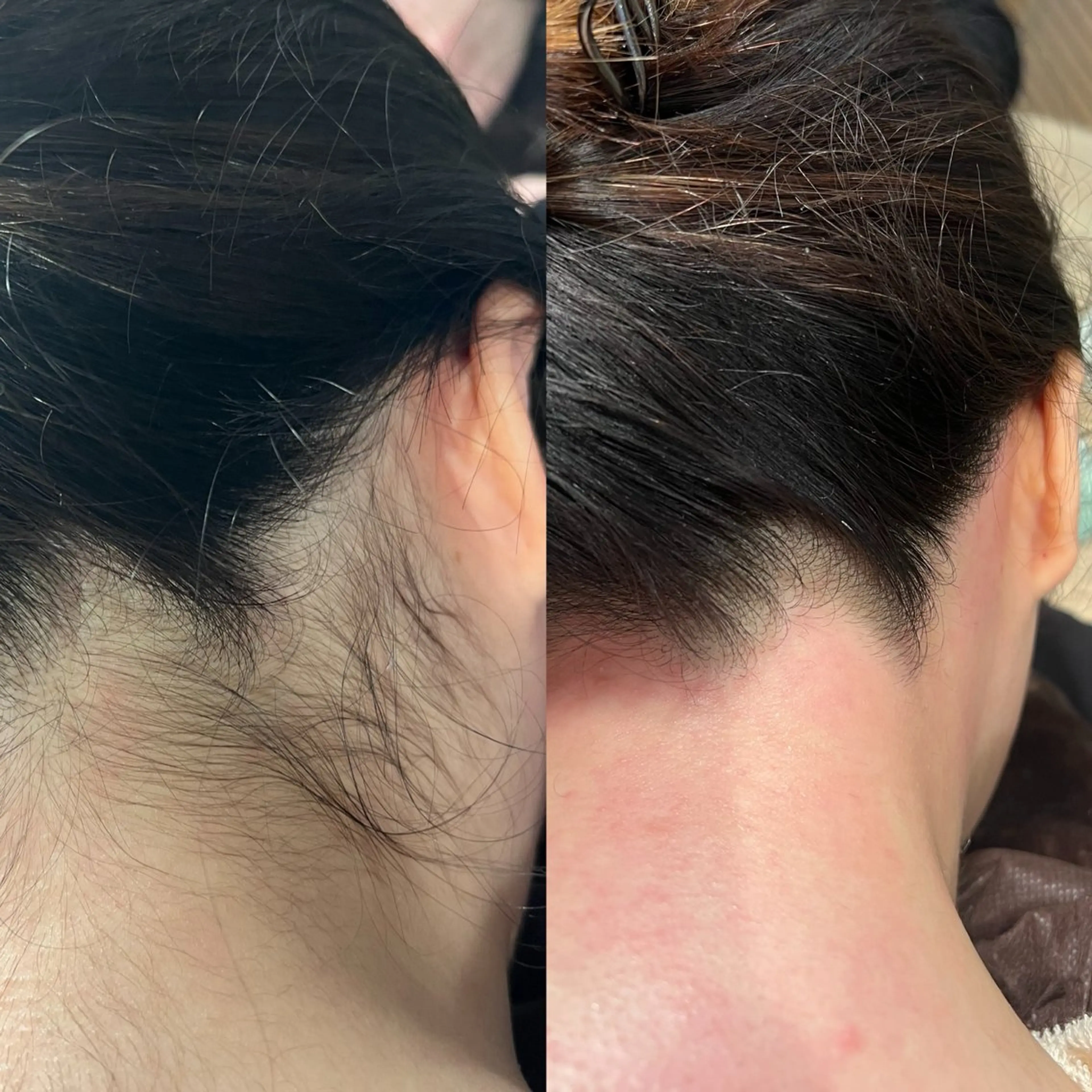 うなじワックスの写真