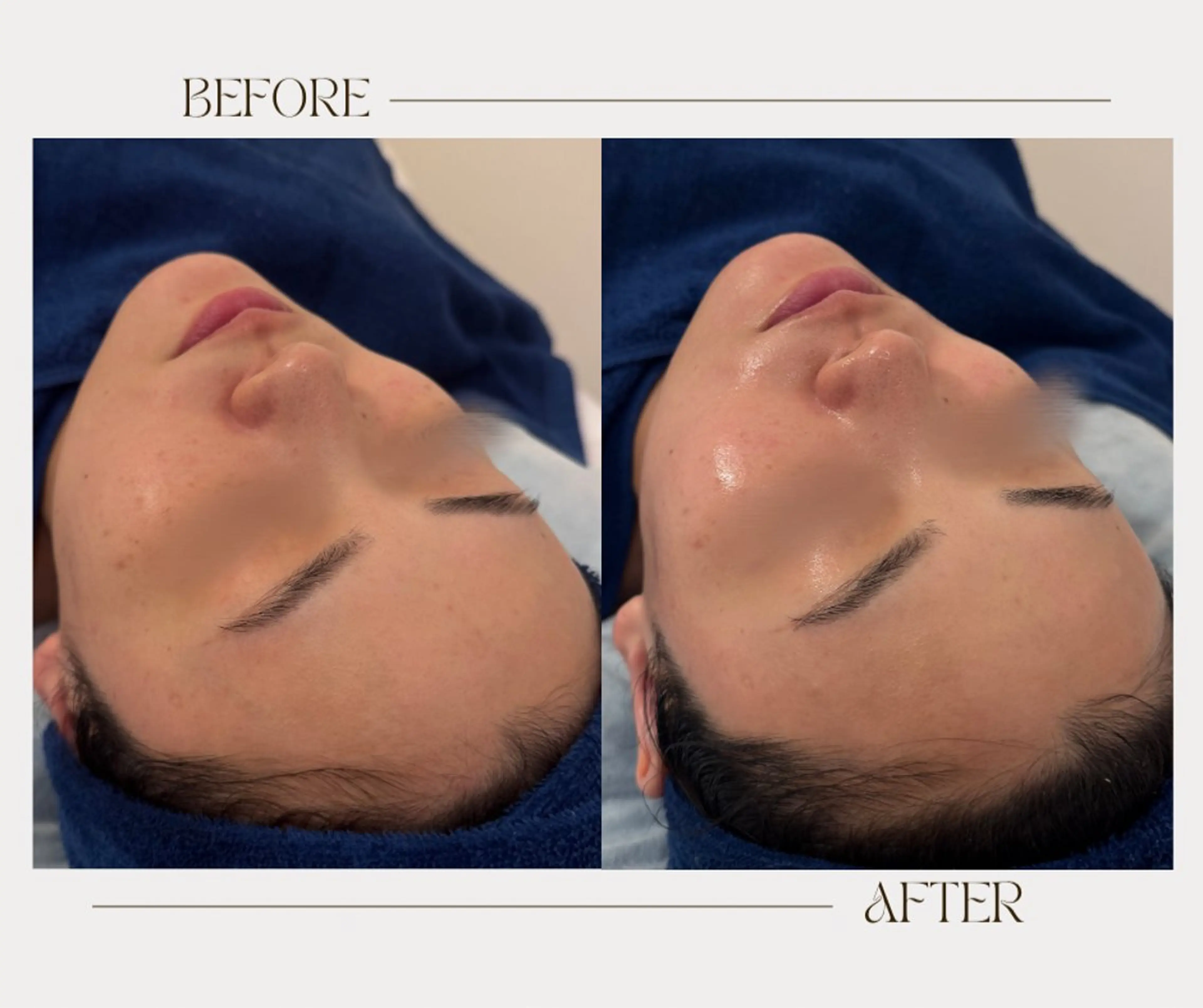 エステ 艶肌ワックス ALLY.のエステ・リラクイメージ