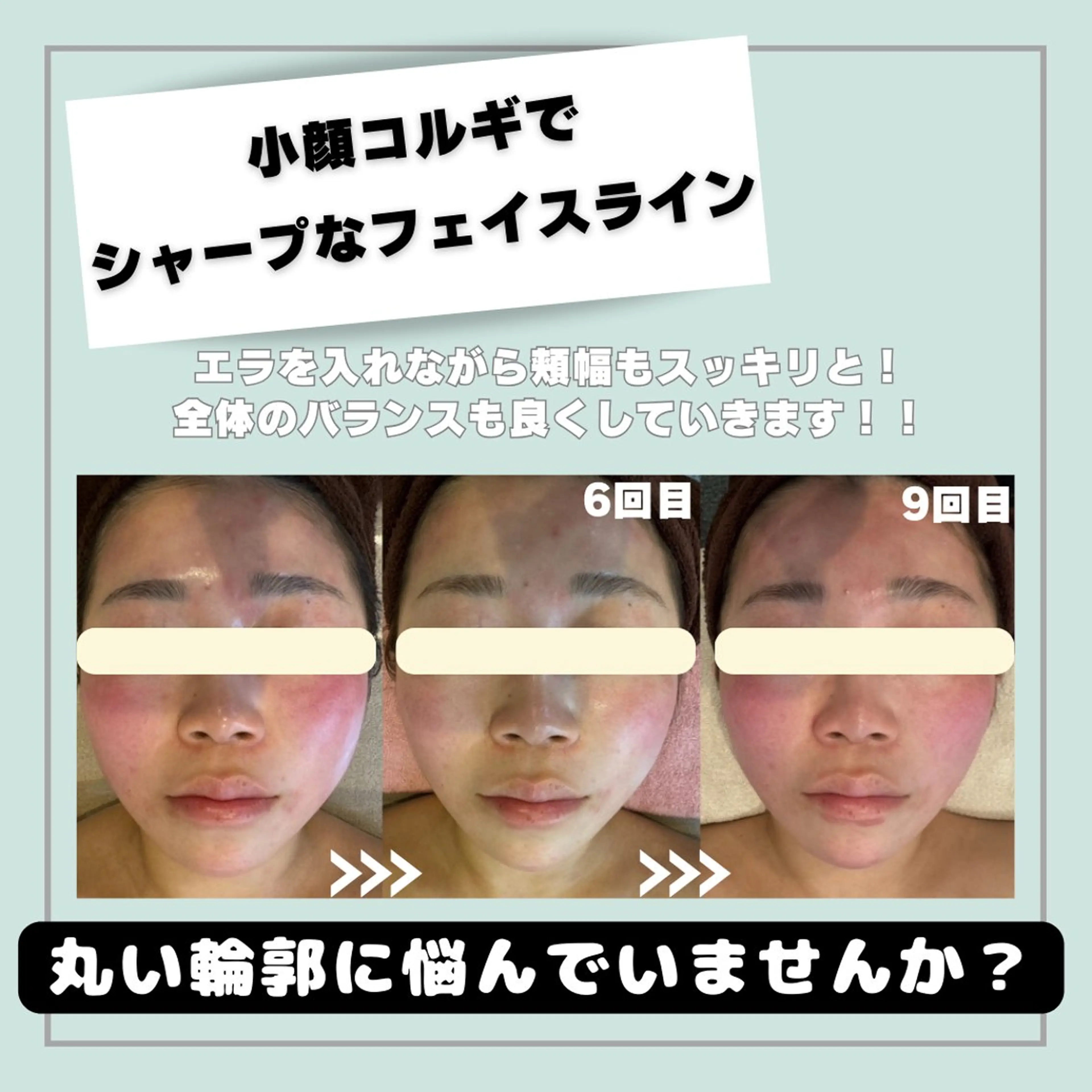 韓国肌管理HARRY ・ハリー🤍大村のエステ・リラクイメージ