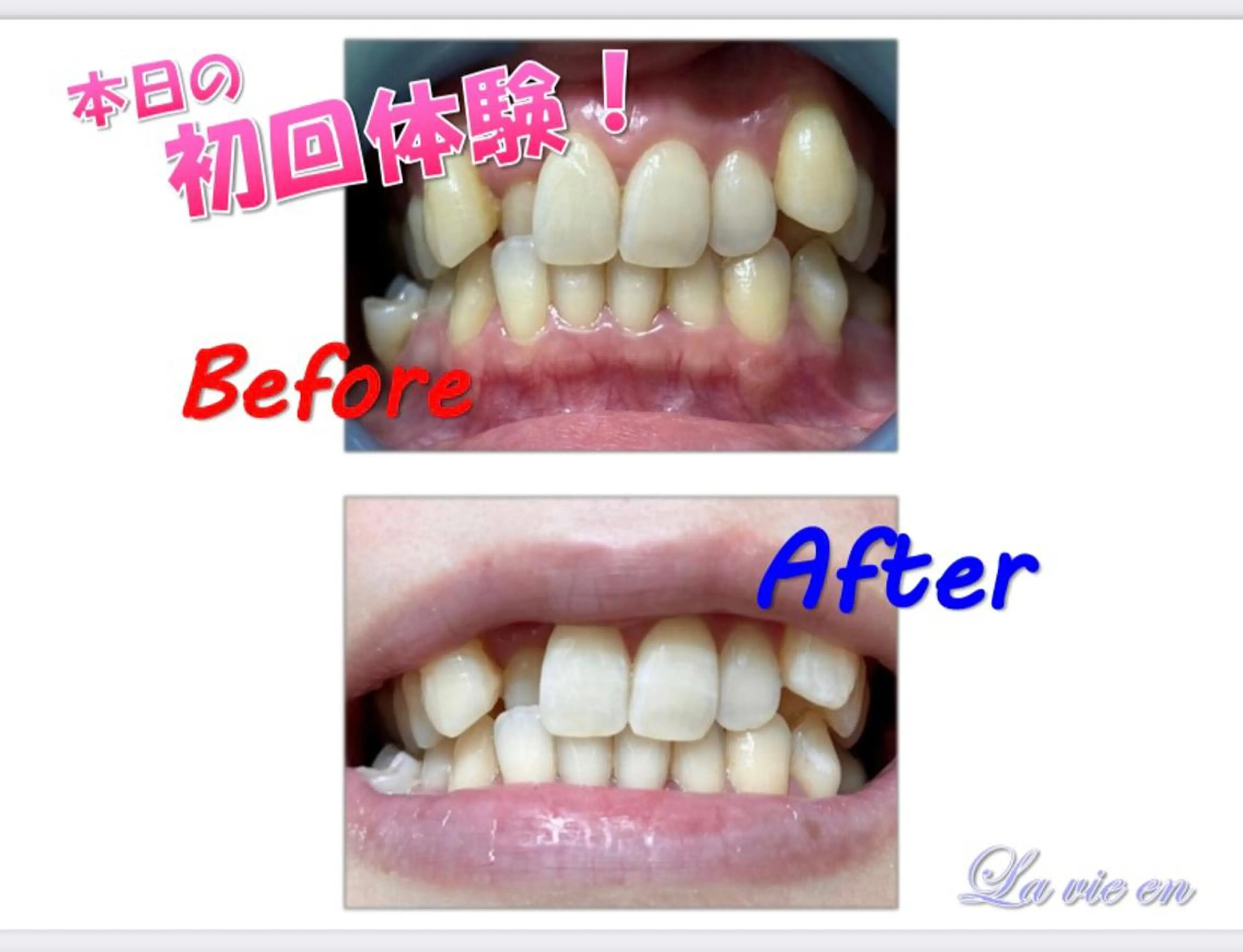 その他 ホワイトニングサロン La vie enのその他イメージ