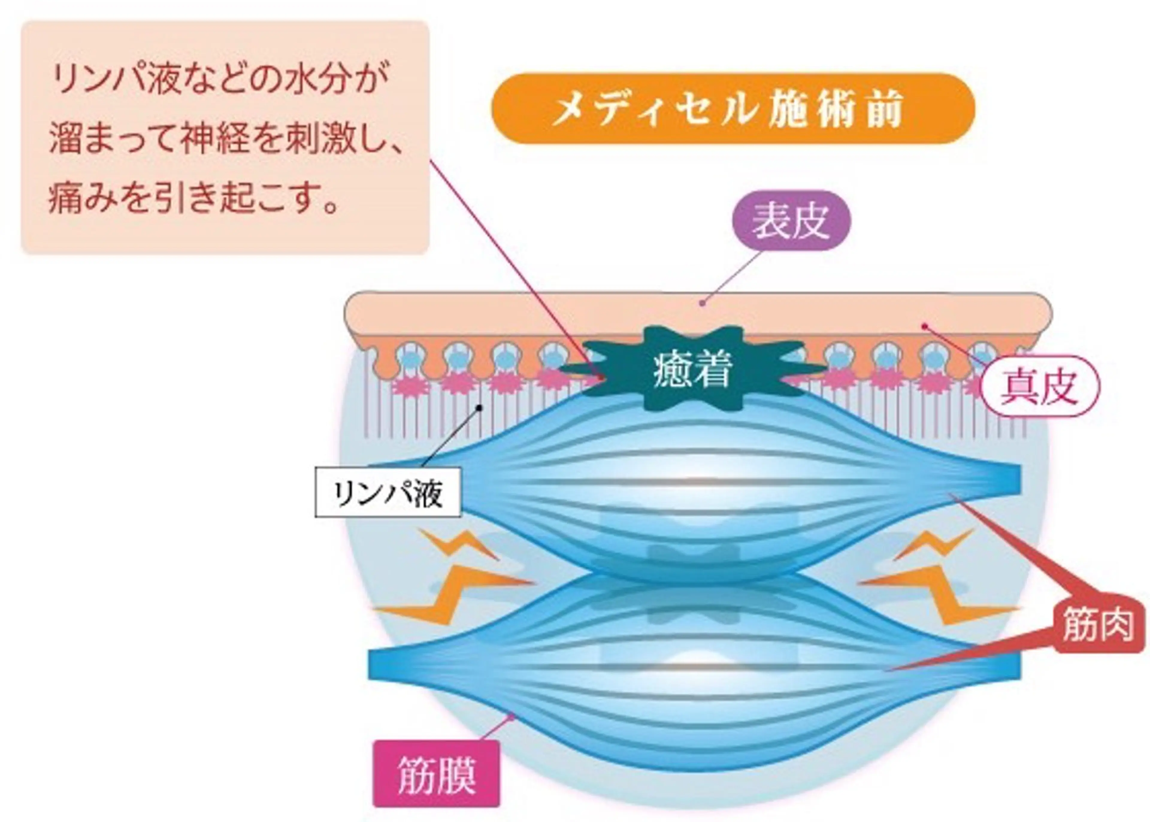 リラク 筋膜リリース骨盤矯正 いずみの治療院のエステ・リラクイメージ