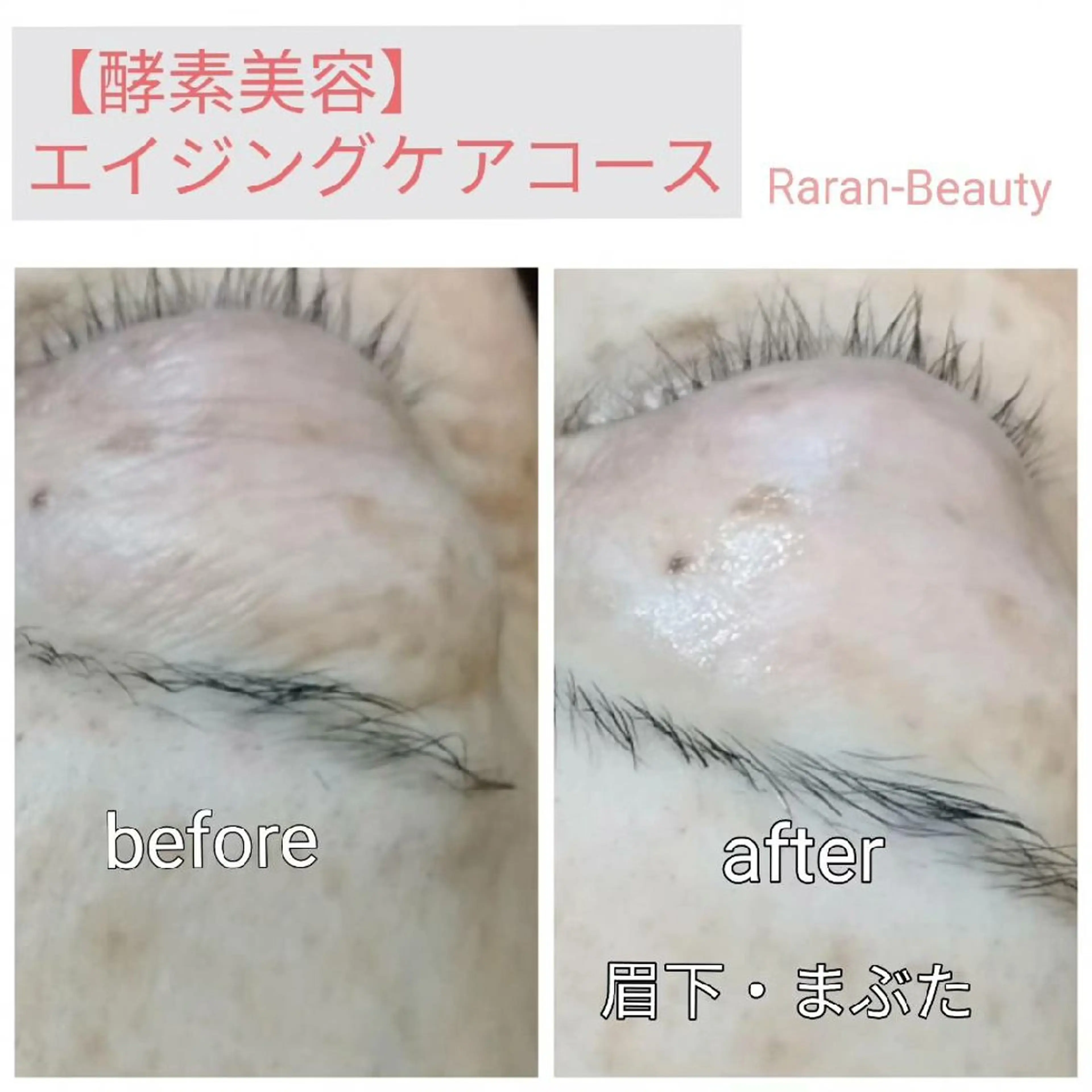 若返り 美肌   エステサロンららんのエステ・リラクイメージ