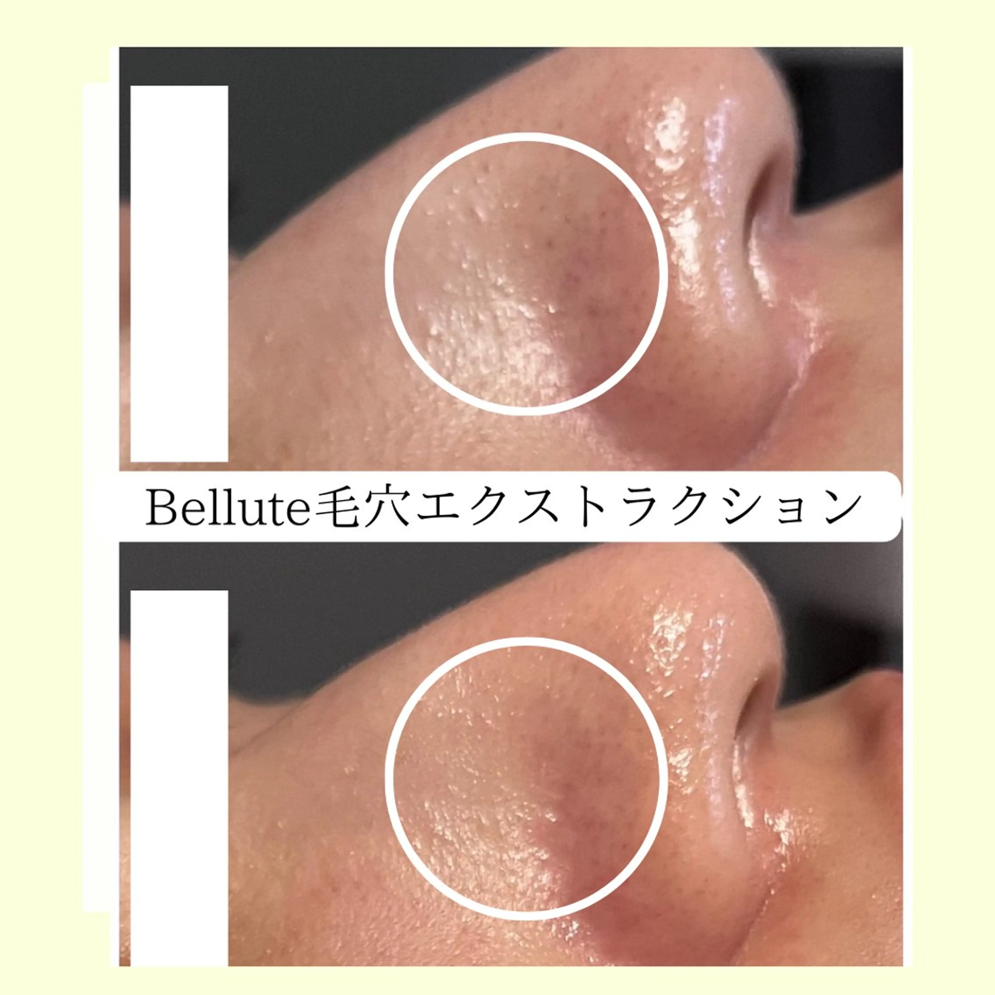 エステ リラク ピーリング専門店 Belluteのエステ・リラクイメージ