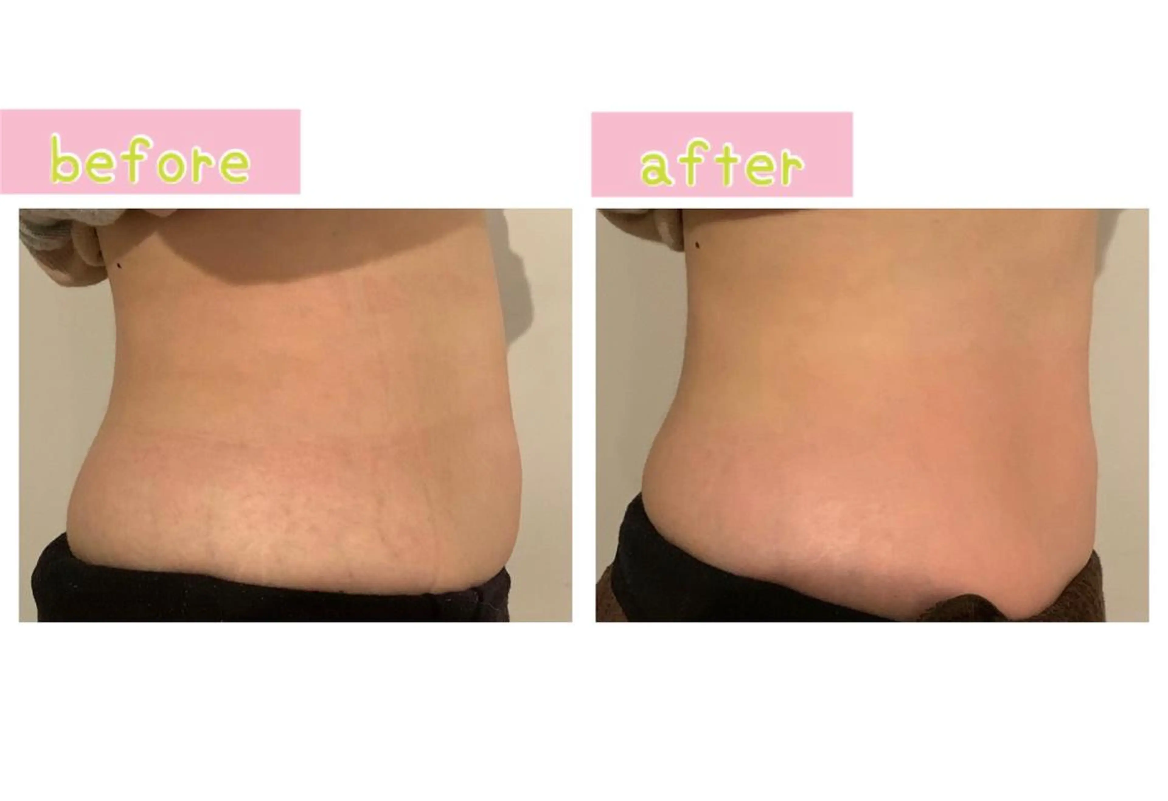 エステ 癒し腸もみサロン シャユーム　ゆきなのエステ・リラクイメージ