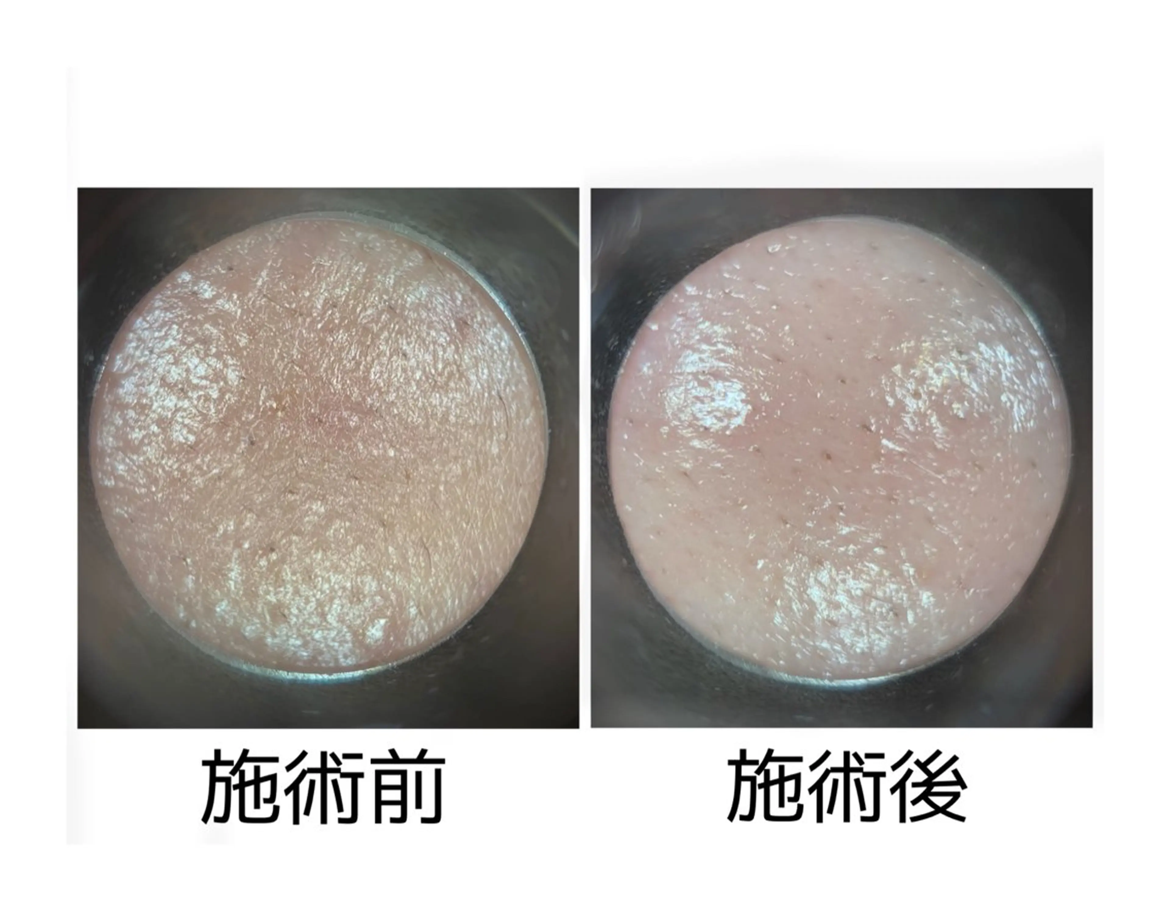 メナード丸の内ヒルズ 柳田りさのエステ・リラクイメージ