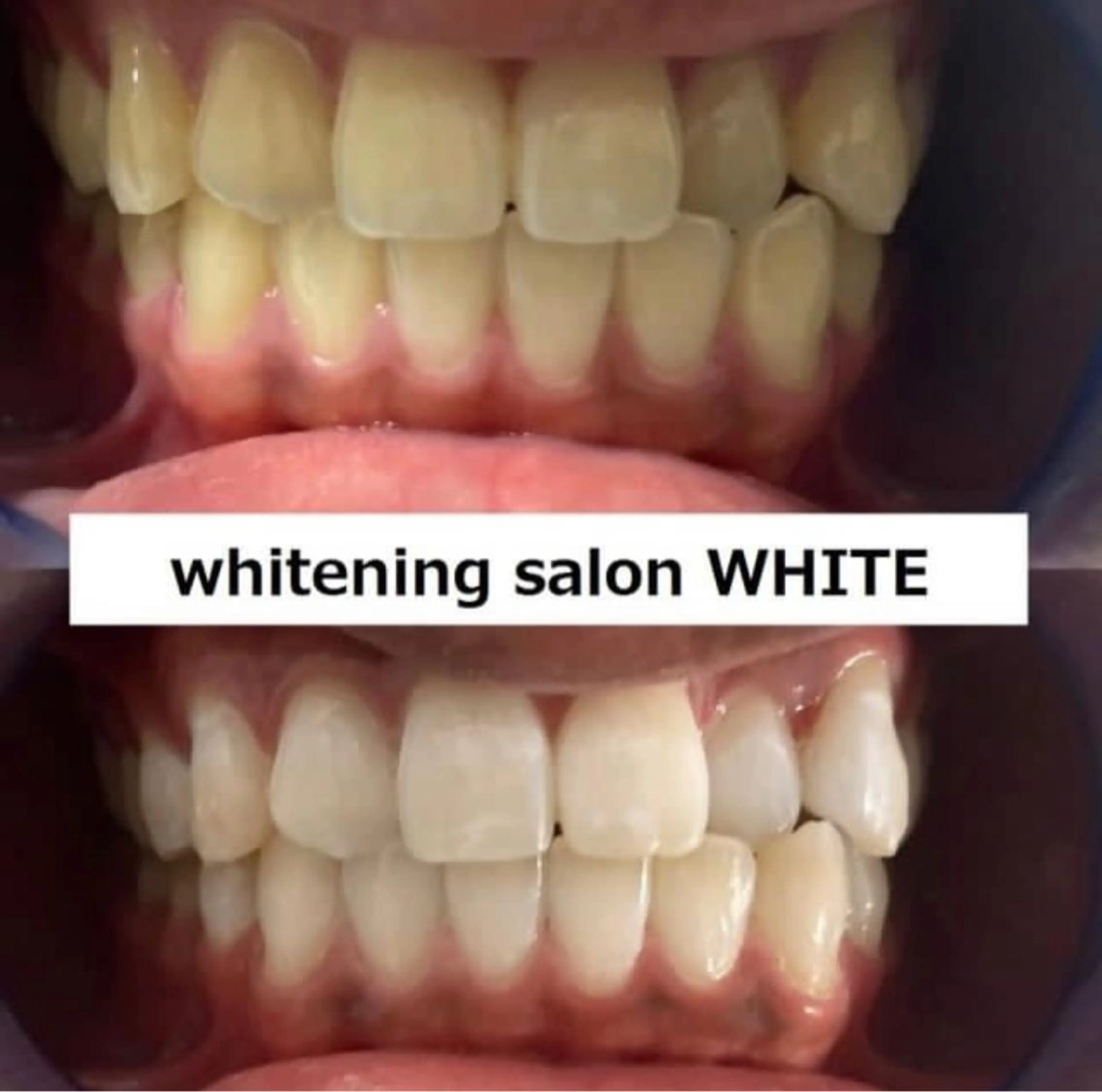 whitening salon WHITE 広島店所属・セルフホワイトニング 専門店WHITE広島のその他イメージ