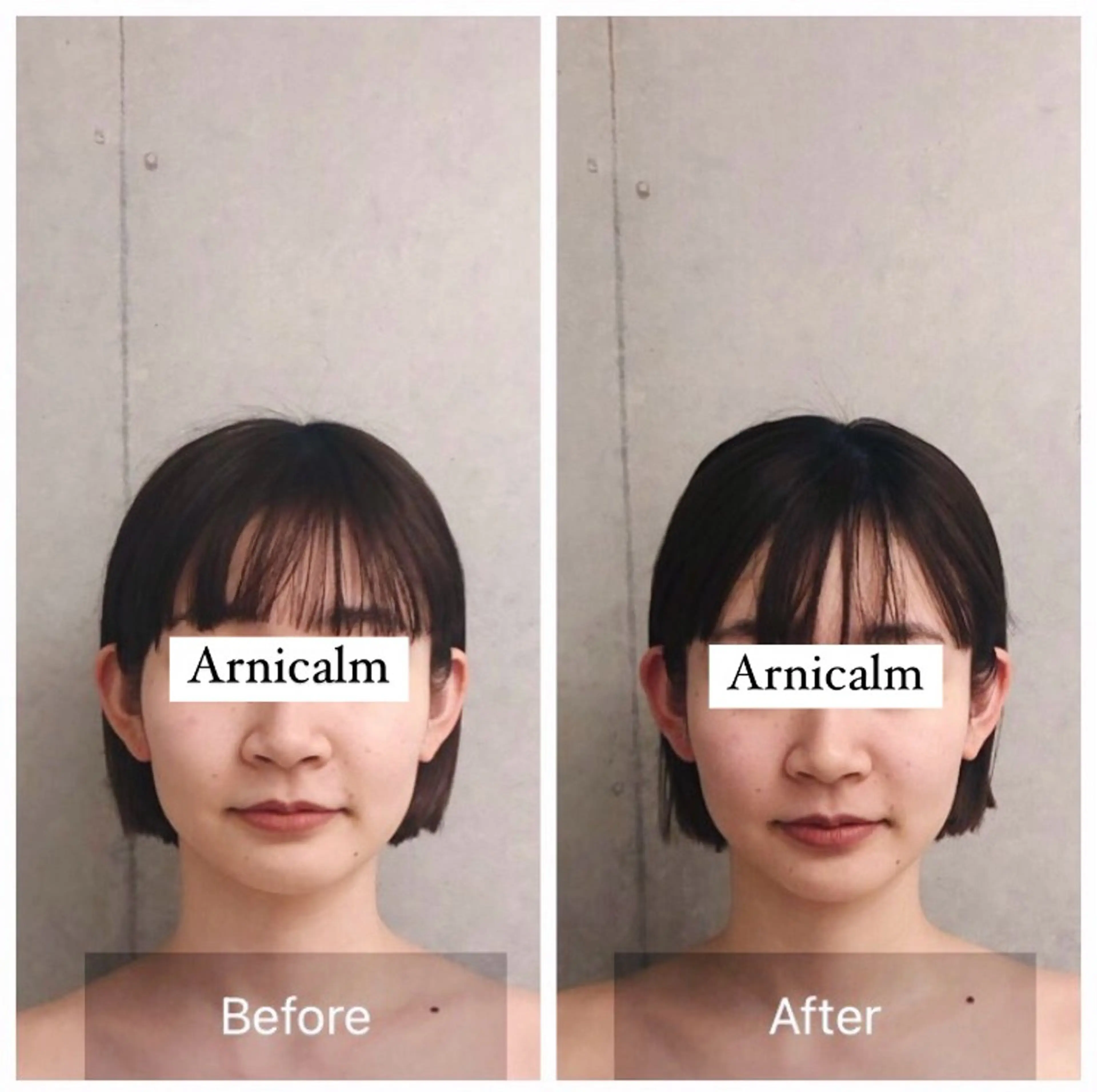 ハーブピーリング 肌再生ピーリング/のエステ・リラクイメージ