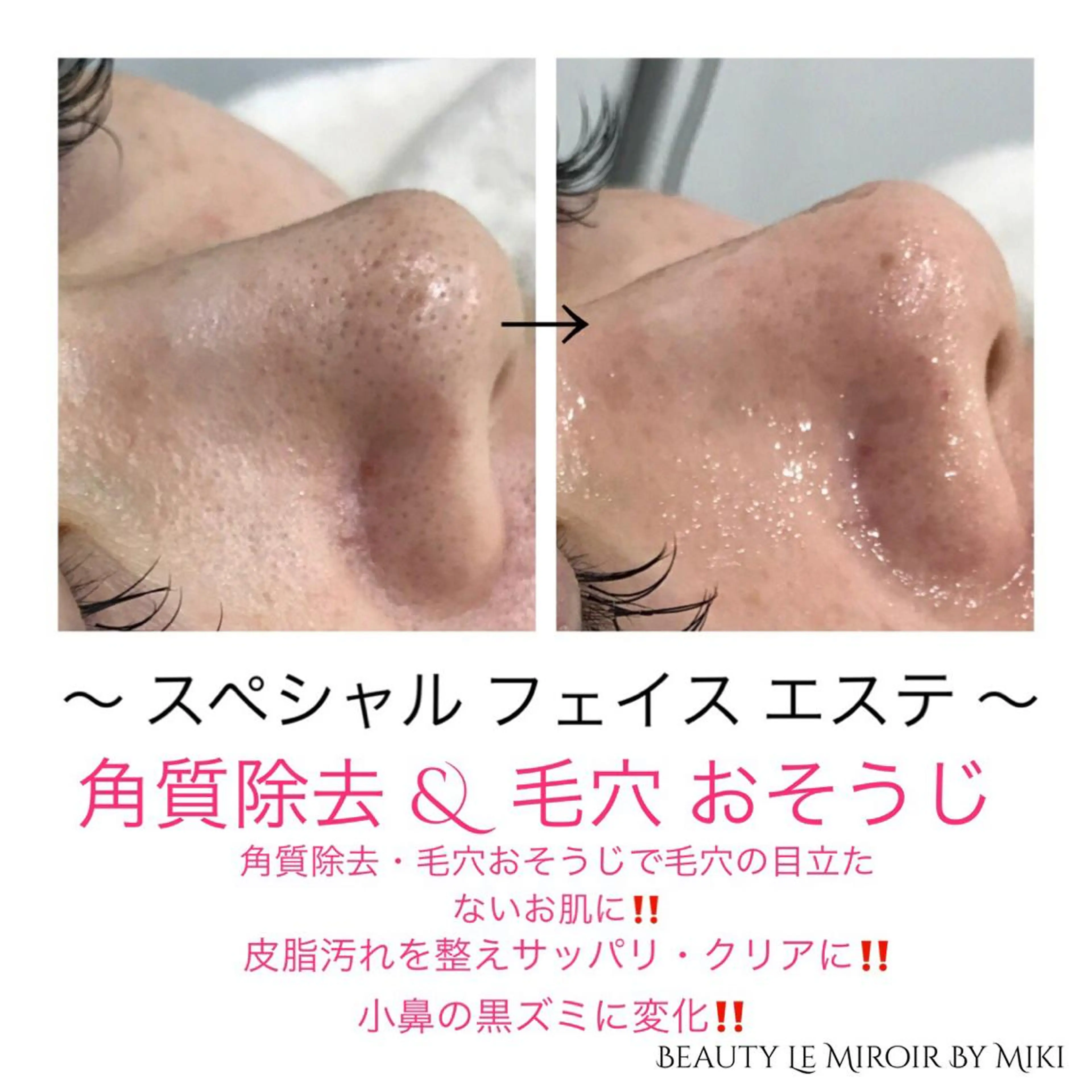 ビューティー ミロワールのエステ・リラクイメージ