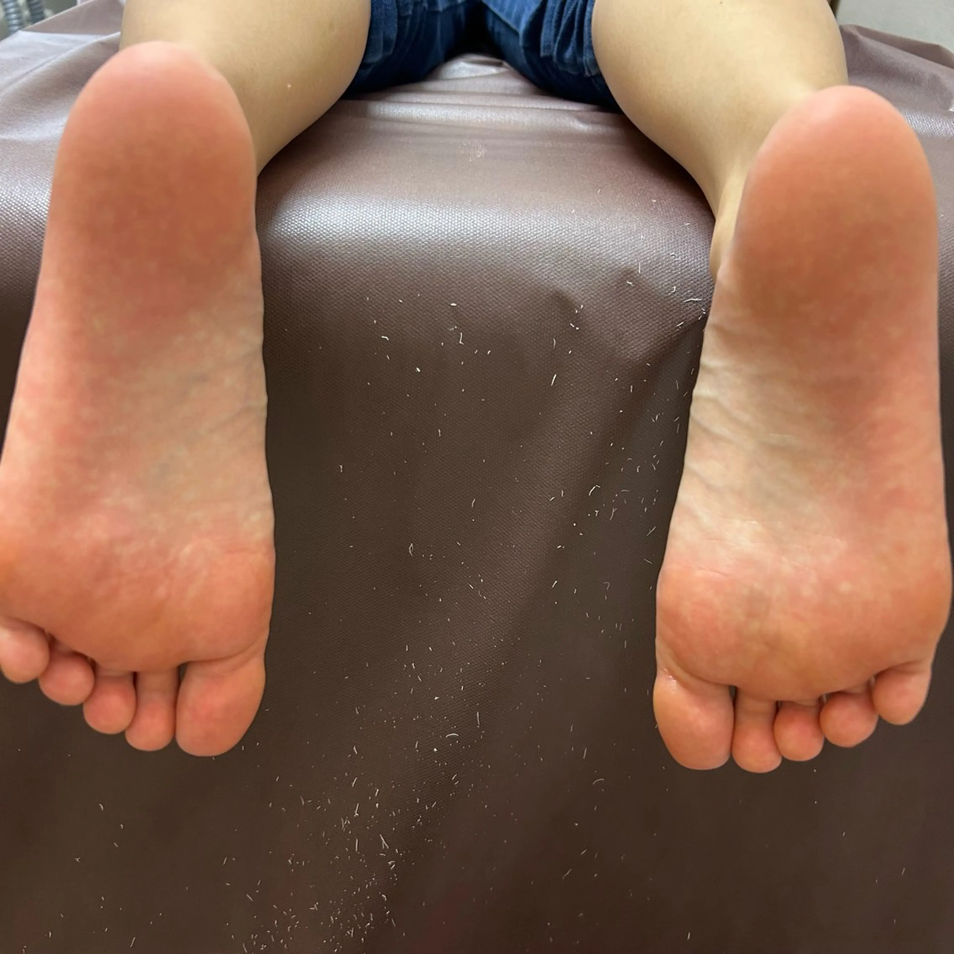 大人気!韓国式🇰🇷フット角質ケア👣🌟(通常料金6600円→ミニモ限定5500円)の写真