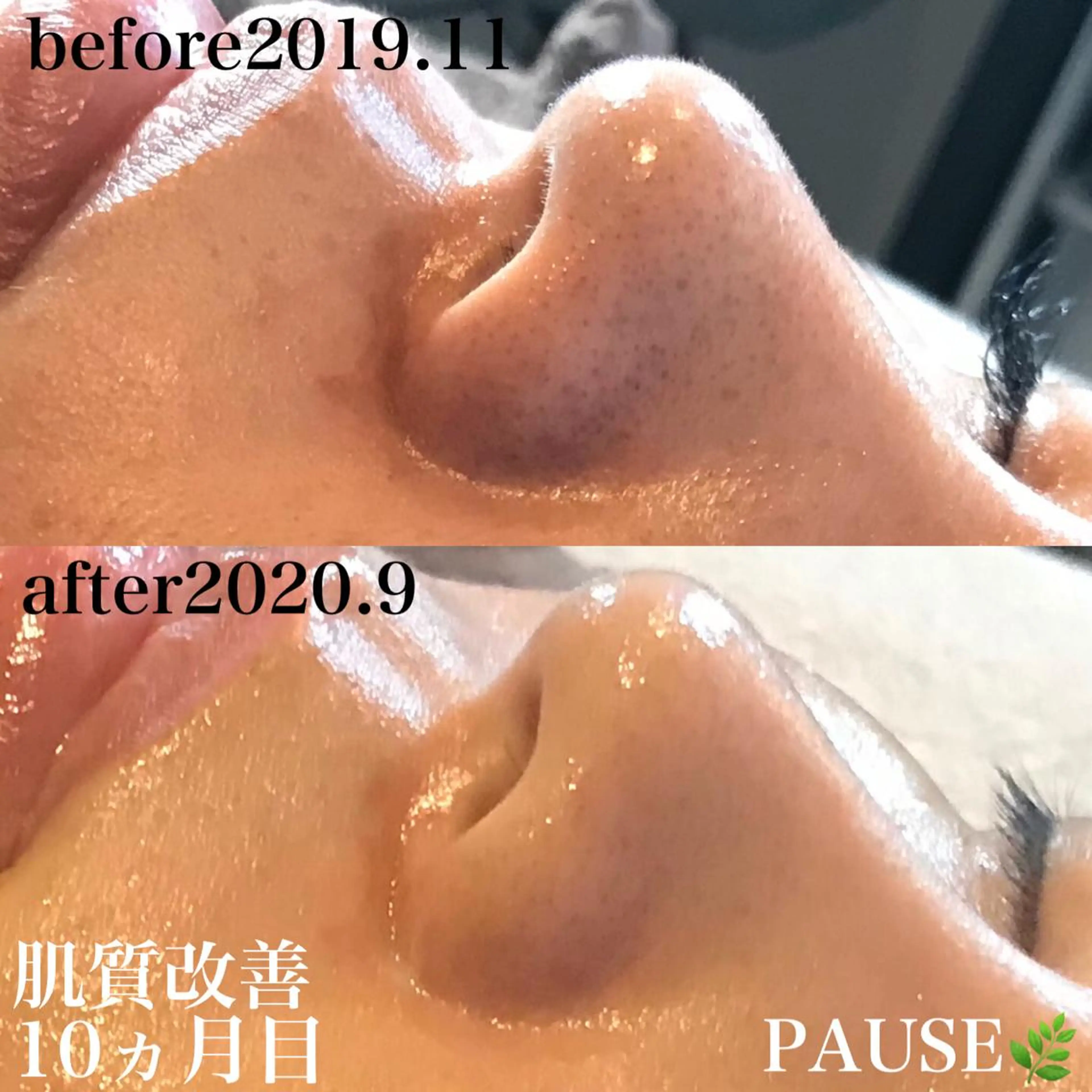 エステ 浜野 恵美のエステ・リラクイメージ