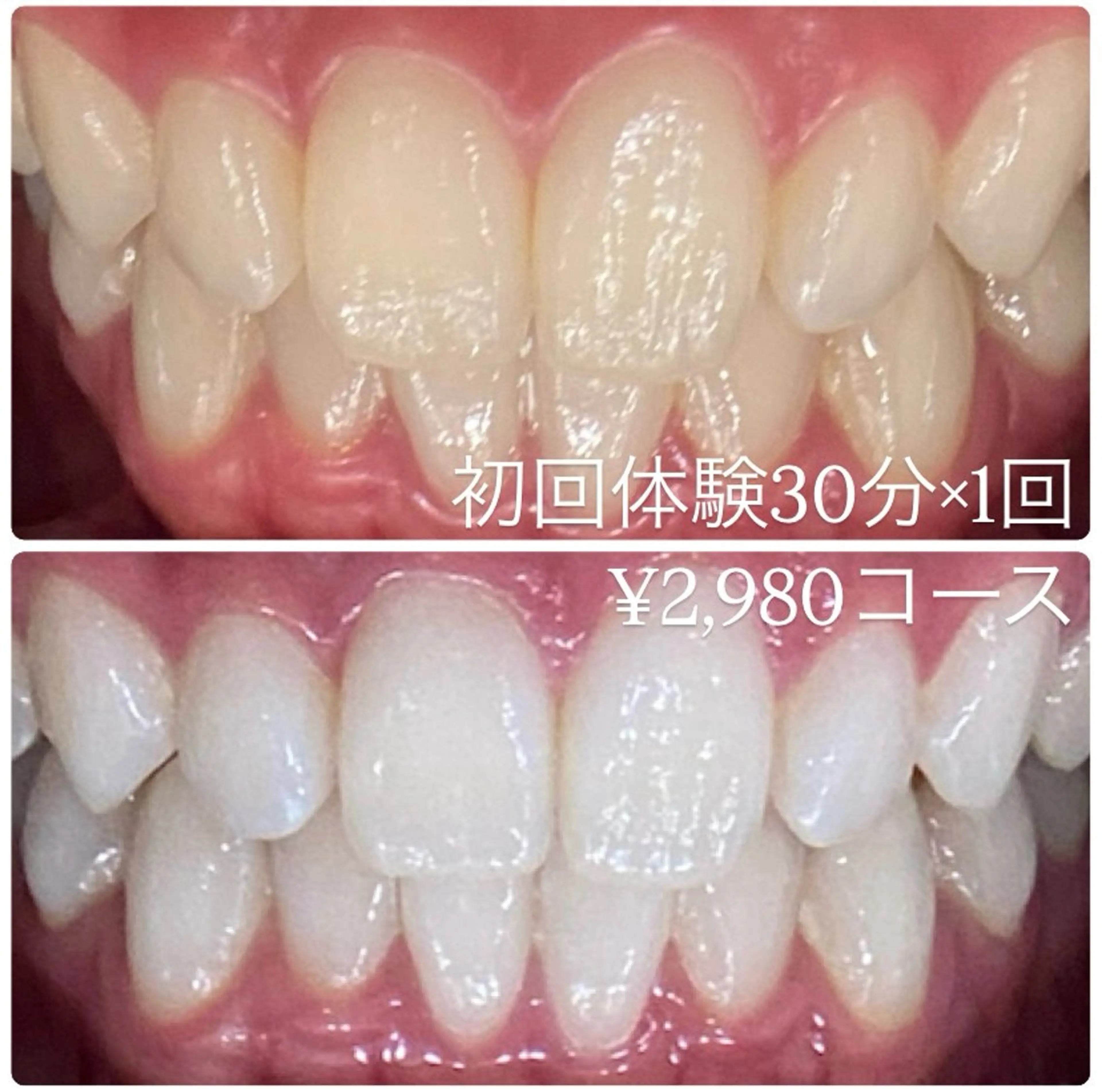 ホワイトニングルーム 横浜店のその他イメージ