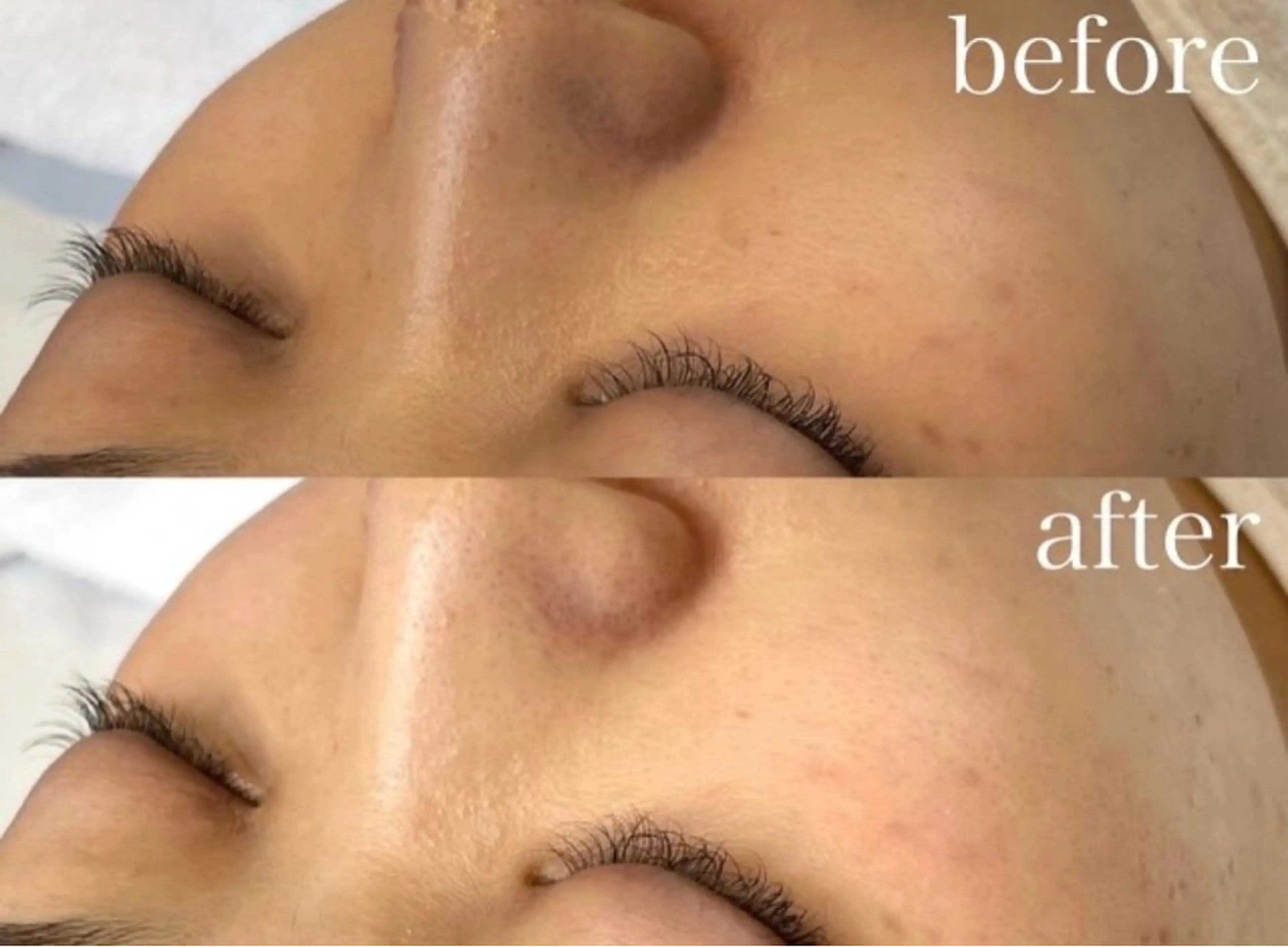 FOXYLASH inoueのエステ・リラクイメージ