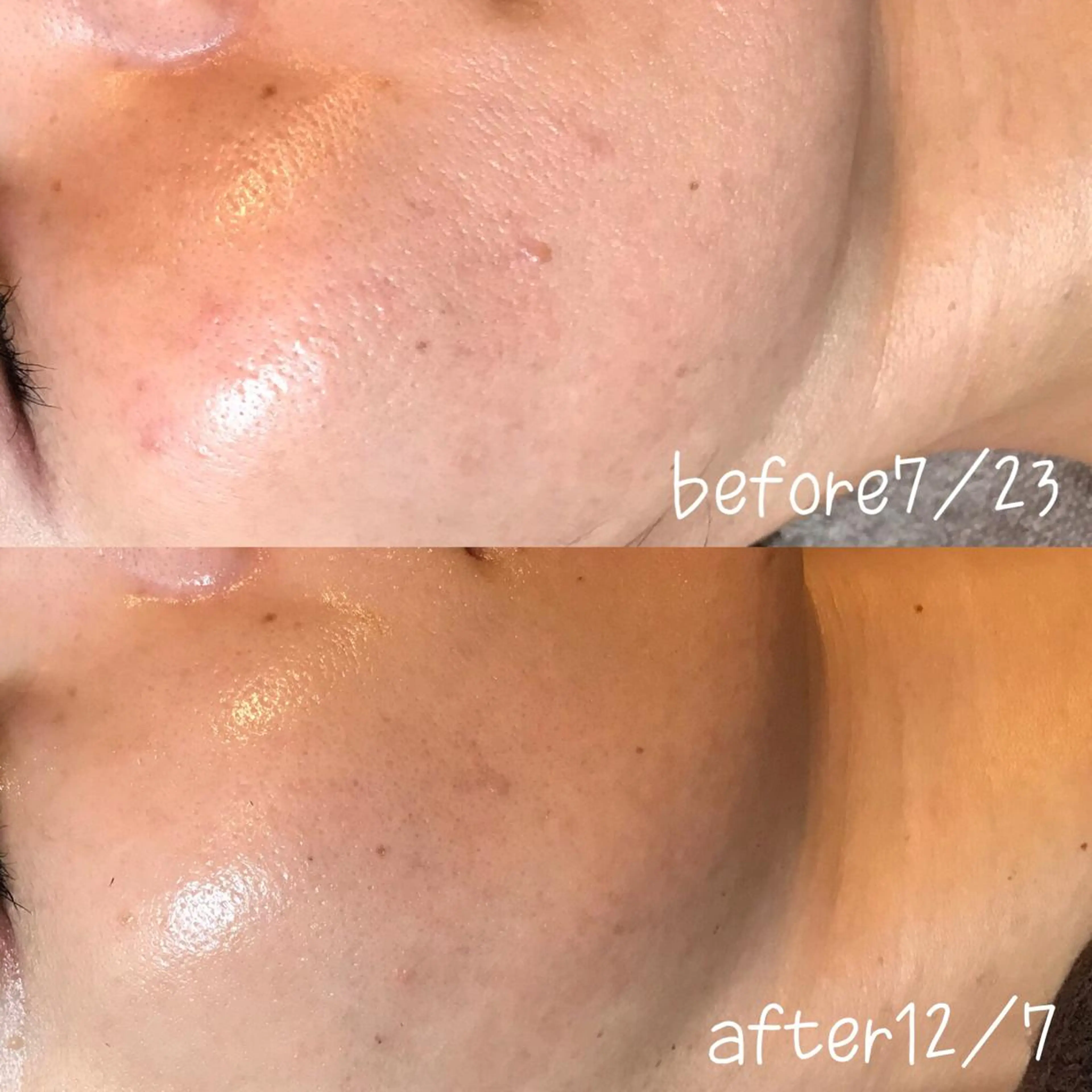 エステ 浜野 恵美のエステ・リラクイメージ