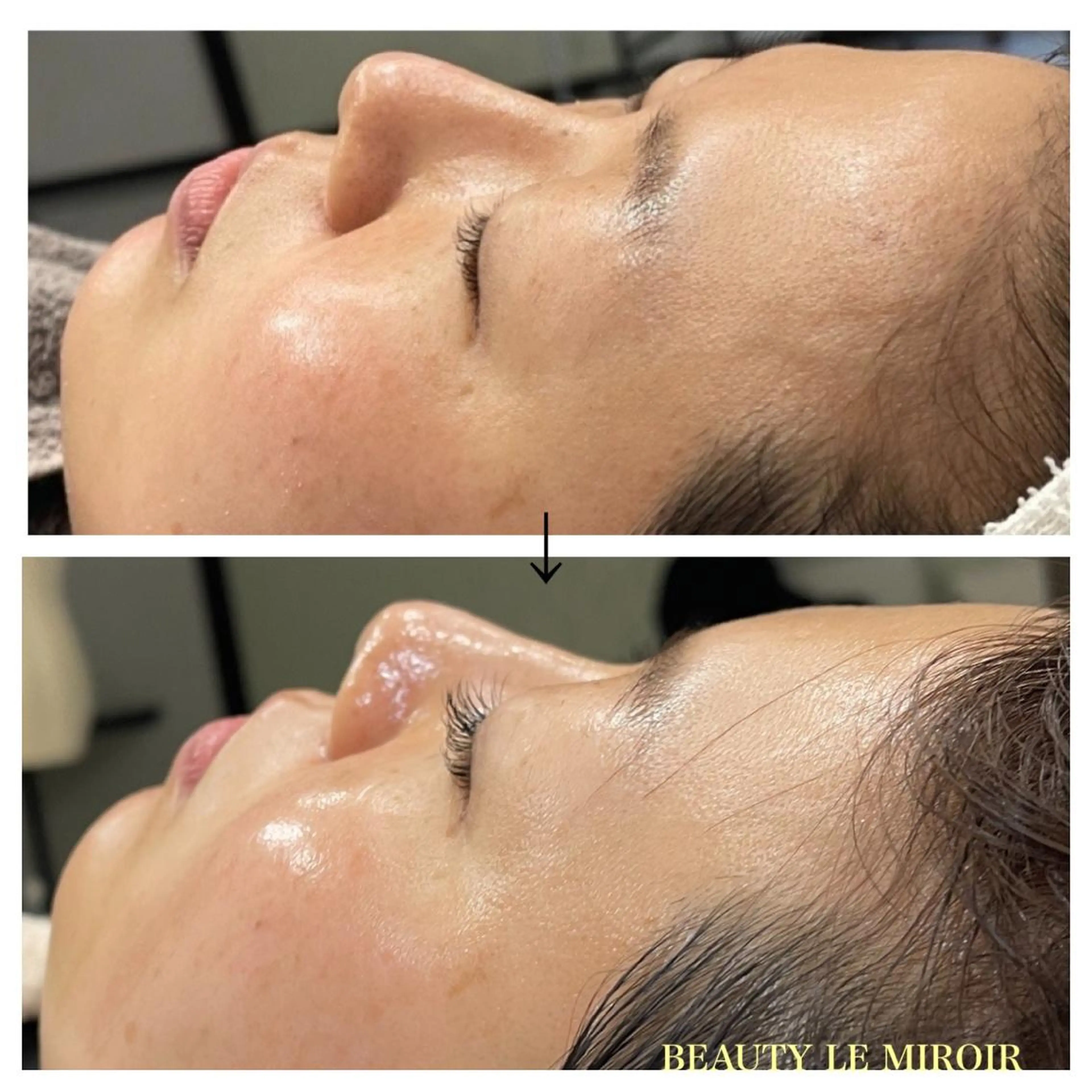 マツエク・マツパ ビューティー ミロワールのエステ・リラクイメージ