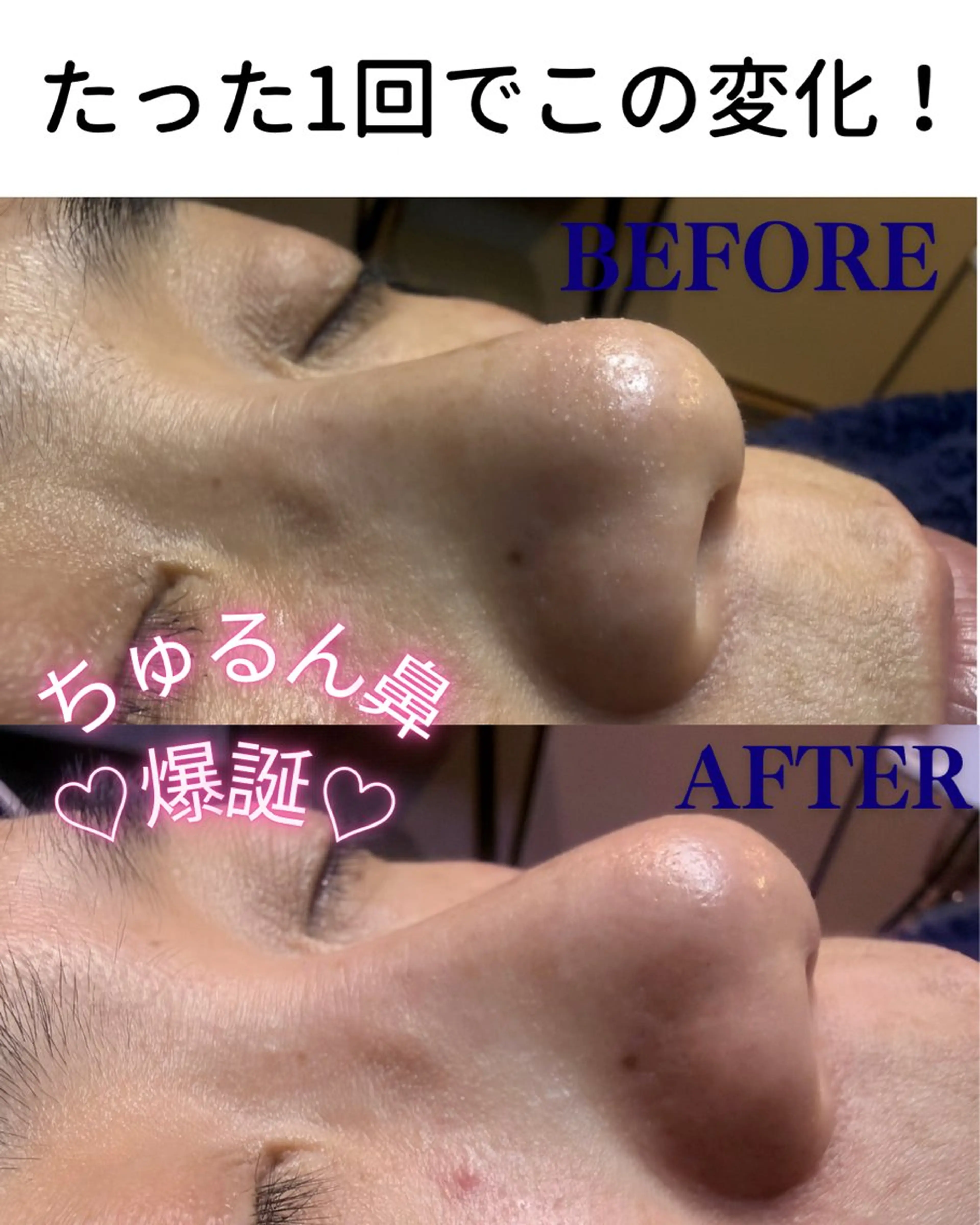 エステ リラク ハーブピーリング専門 店Oneのエステ・リラクイメージ