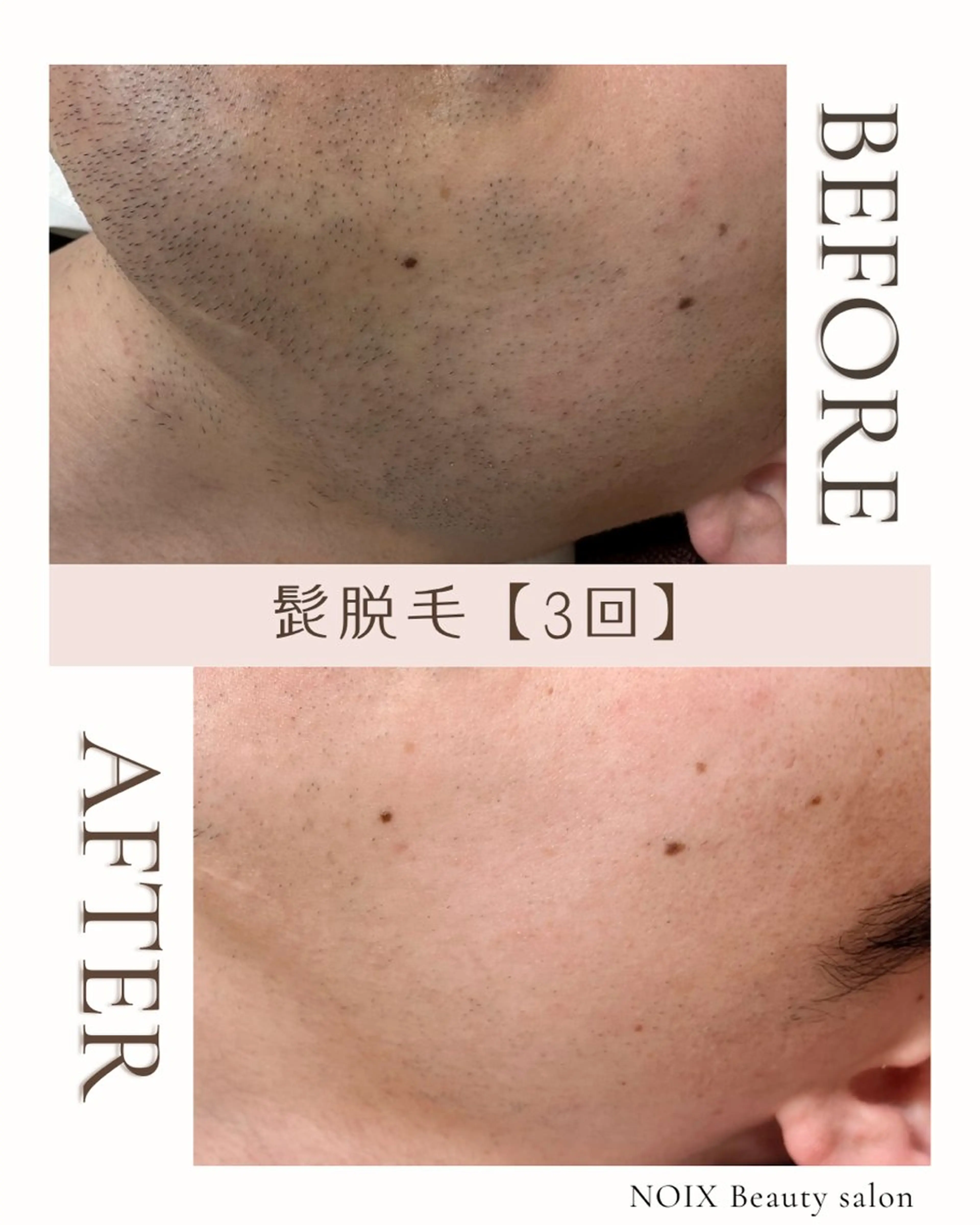 NOIXbeauty salonのエステ・リラクイメージ