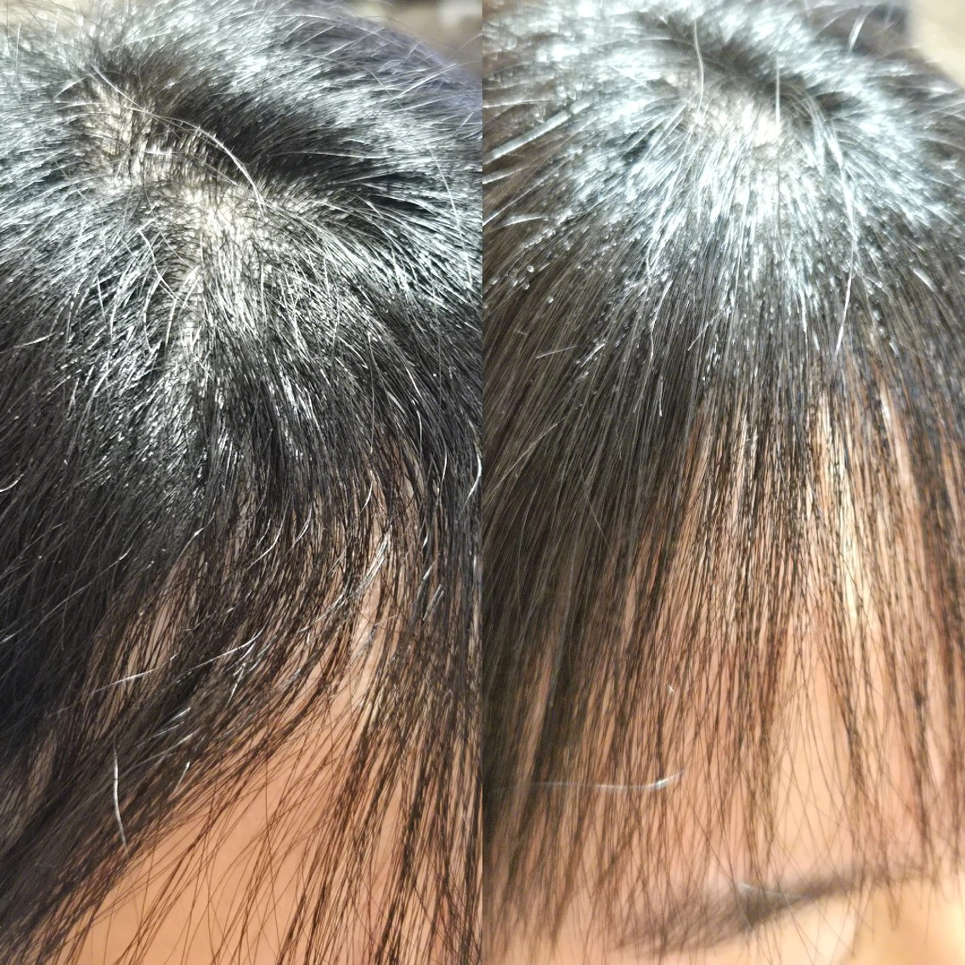 セミロング カット 縮毛矯正 野村 果音(カノン)のヘアスタイル