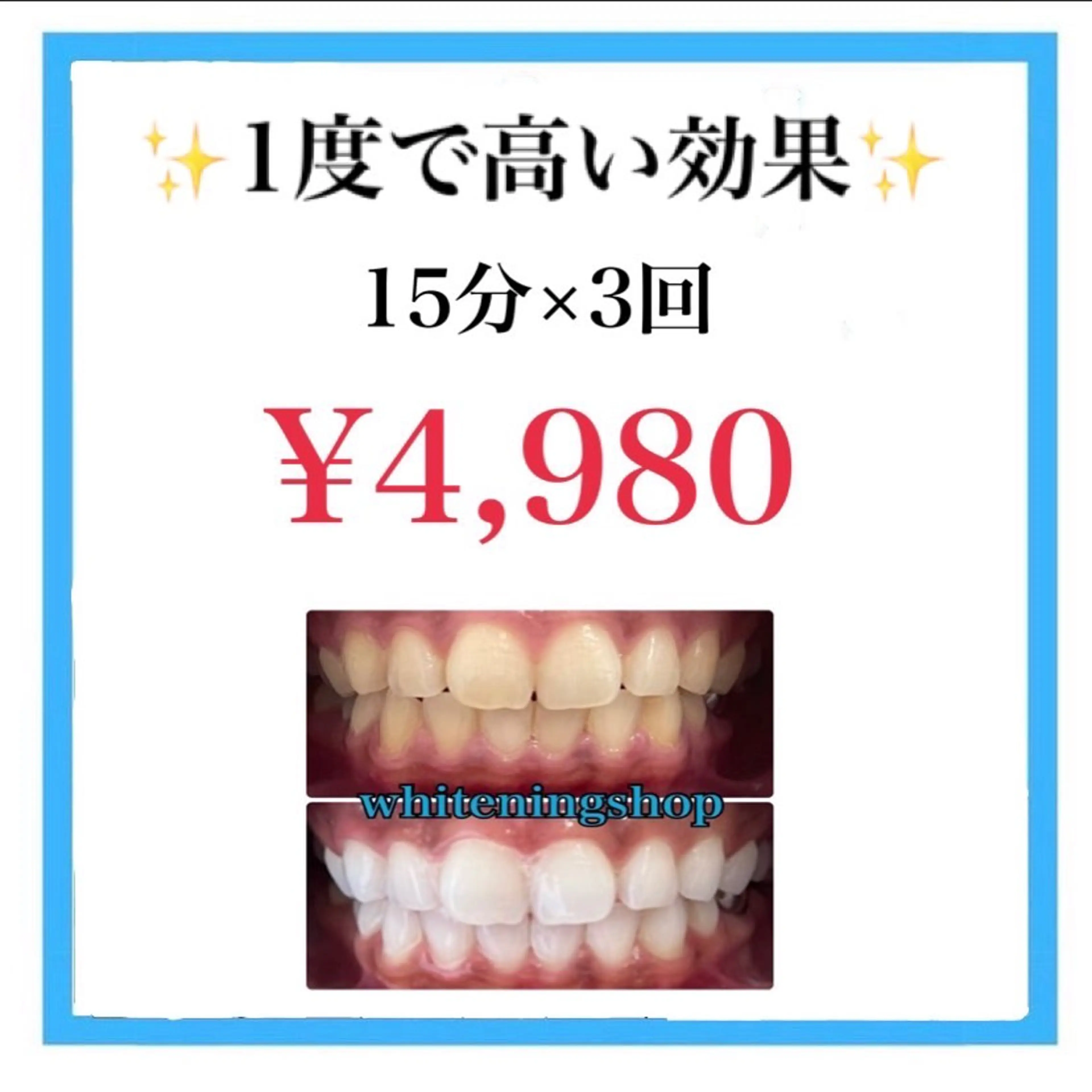 セルフホワイトニング 15分×3回の写真