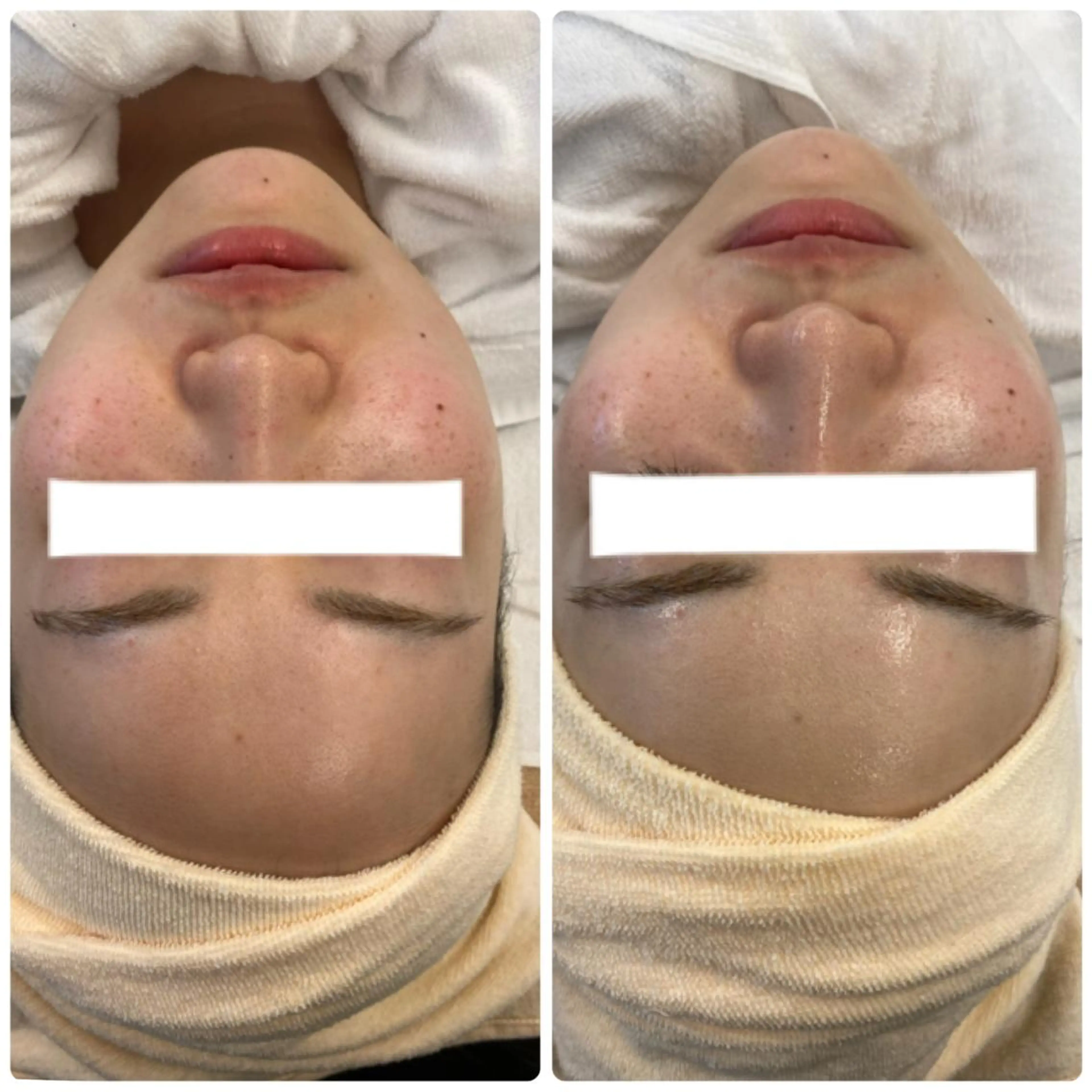 アイブロウ 肌質改善美容サロン ému 用賀のエステ・リラクイメージ