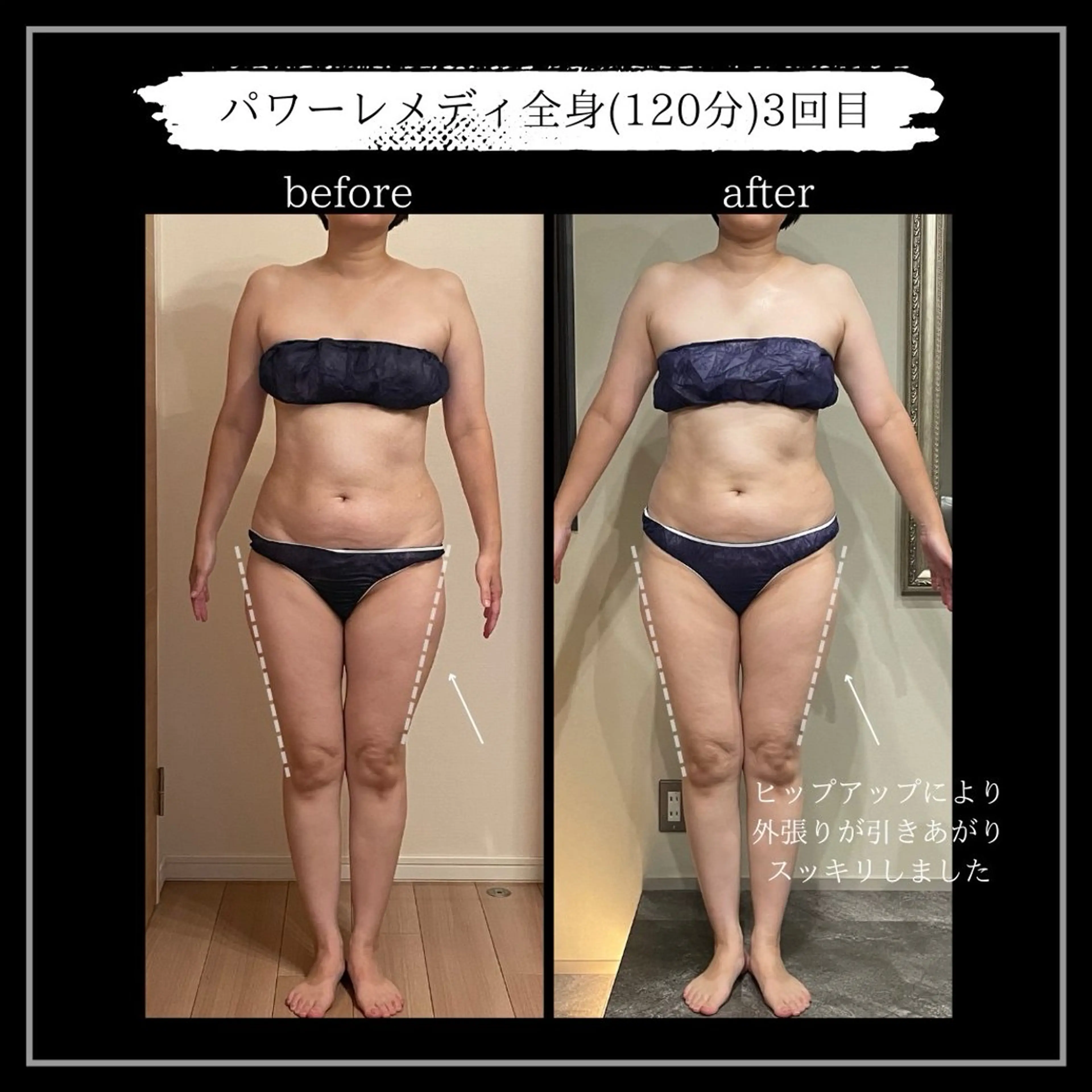 オフ:オン 全身筋膜マッサージのエステ・リラクイメージ