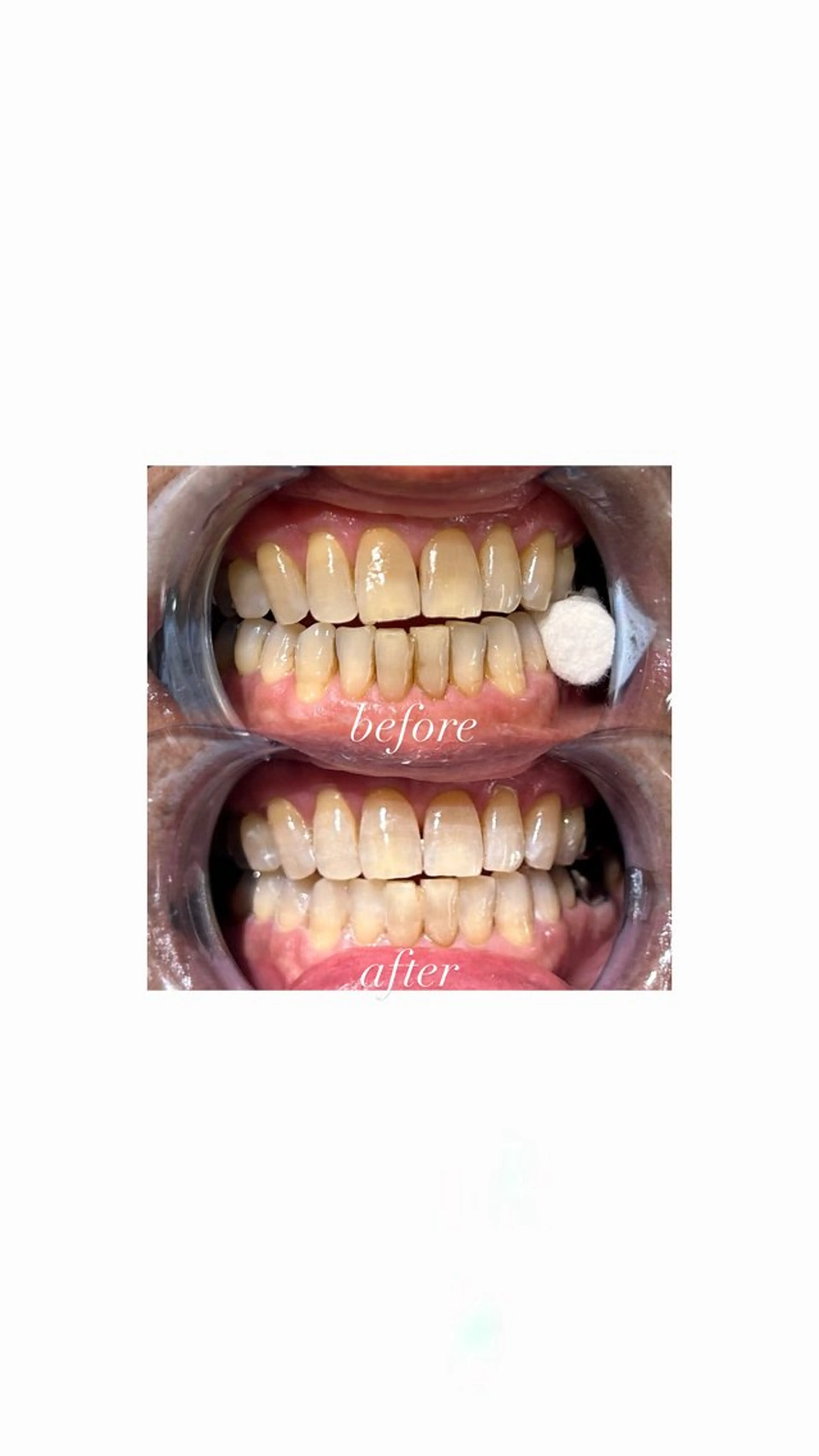 その他 ホワイトニングサロン Bianのその他イメージ