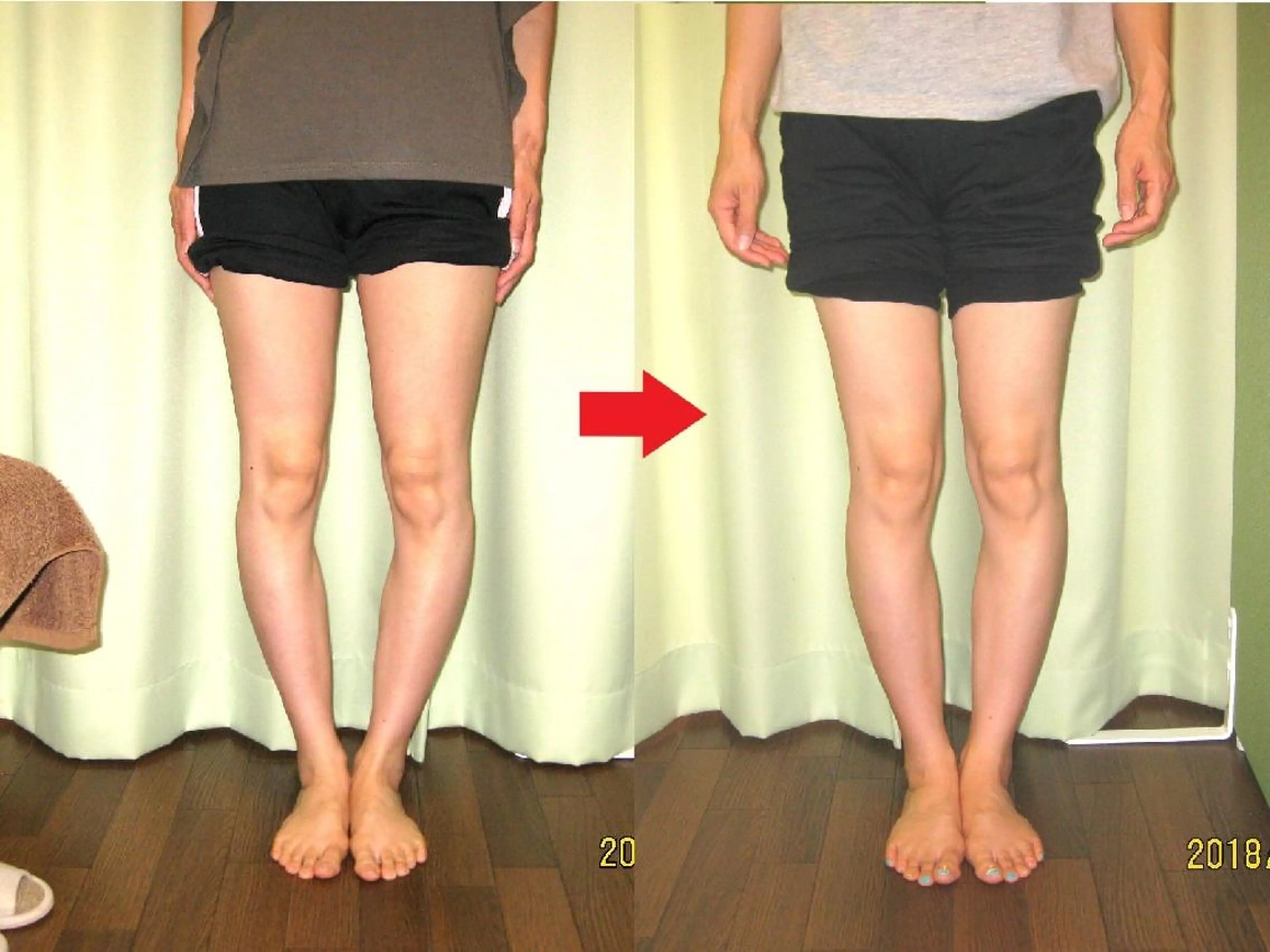 ゆがみ専門整体♪骨盤 姿勢 美脚✨清水貞利のエステ・リラクイメージ