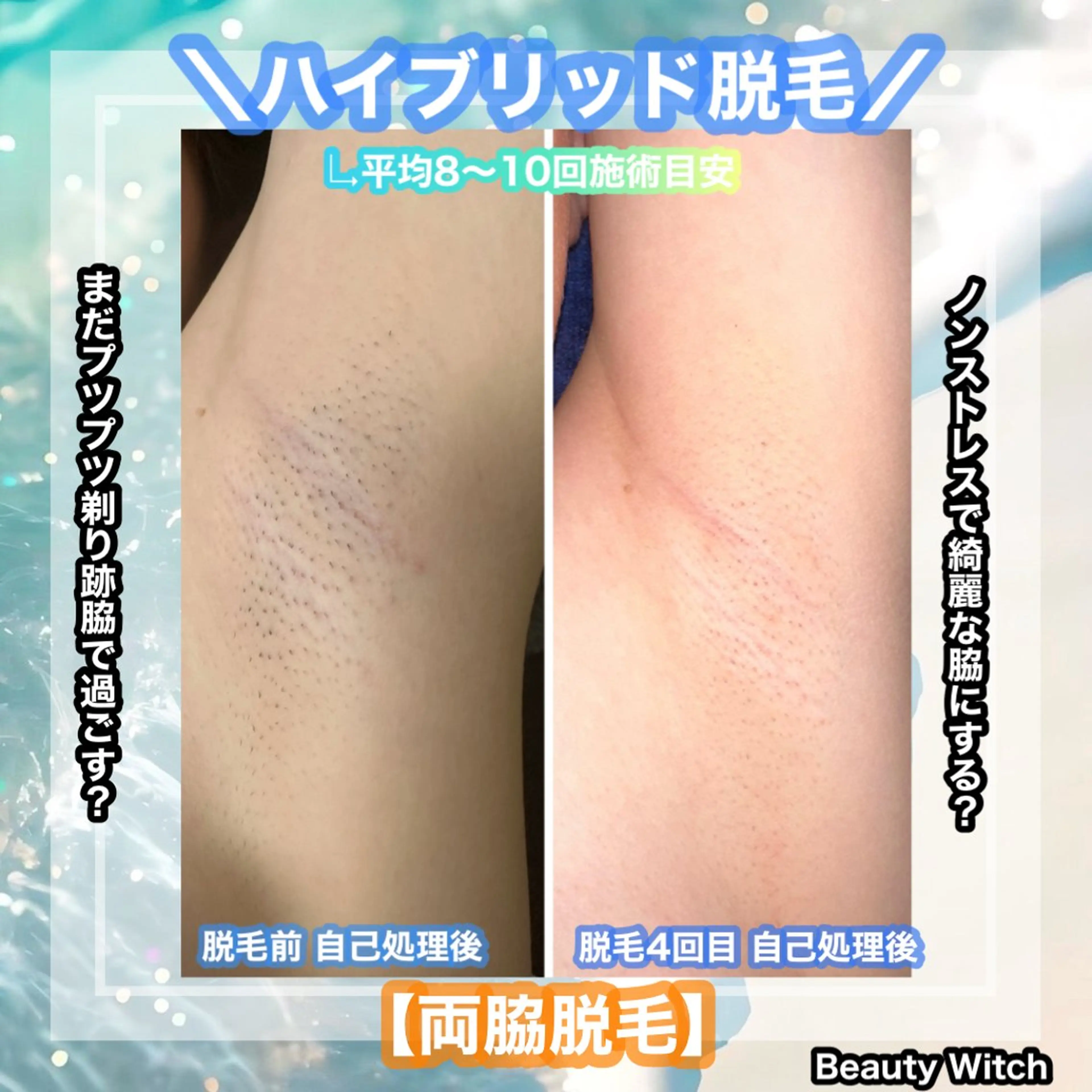 脱毛 痩身/脱毛/ネイル HARUKAのエステ・リラクイメージ