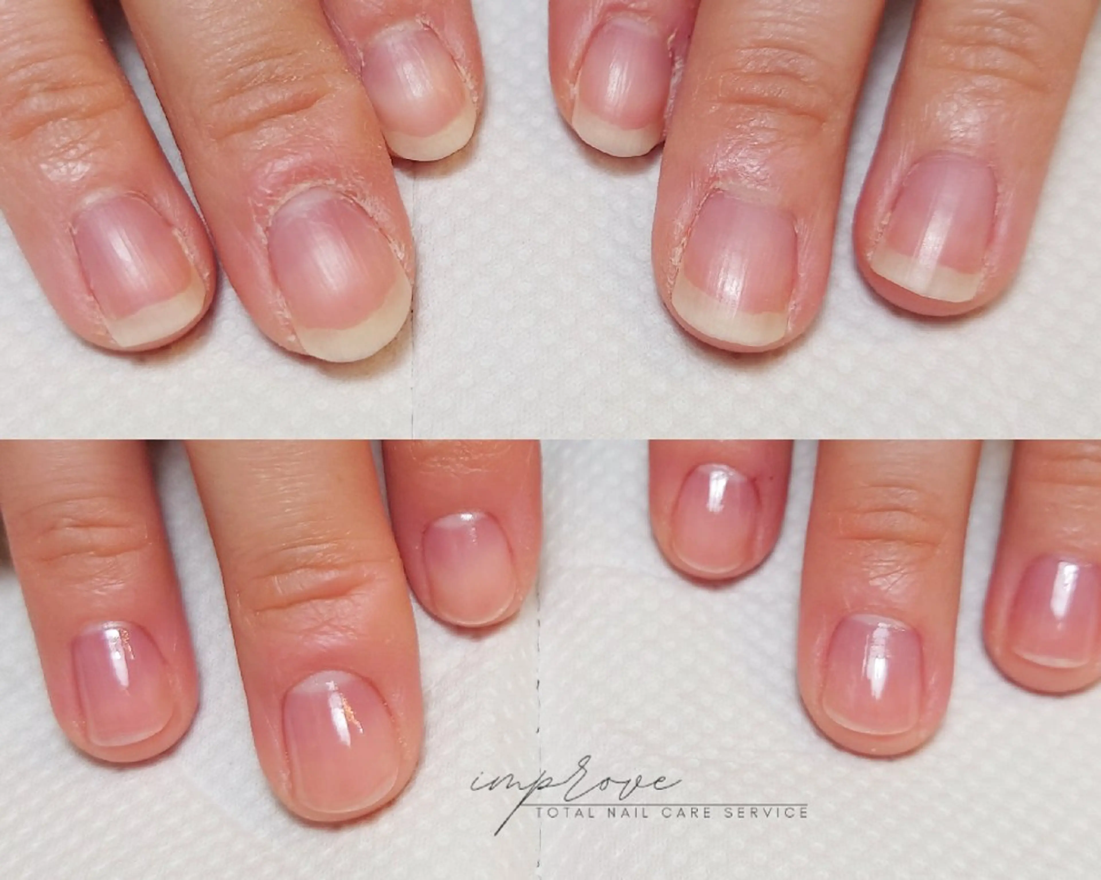 ネイル フットネイル improve /mamiのネイルデザイン