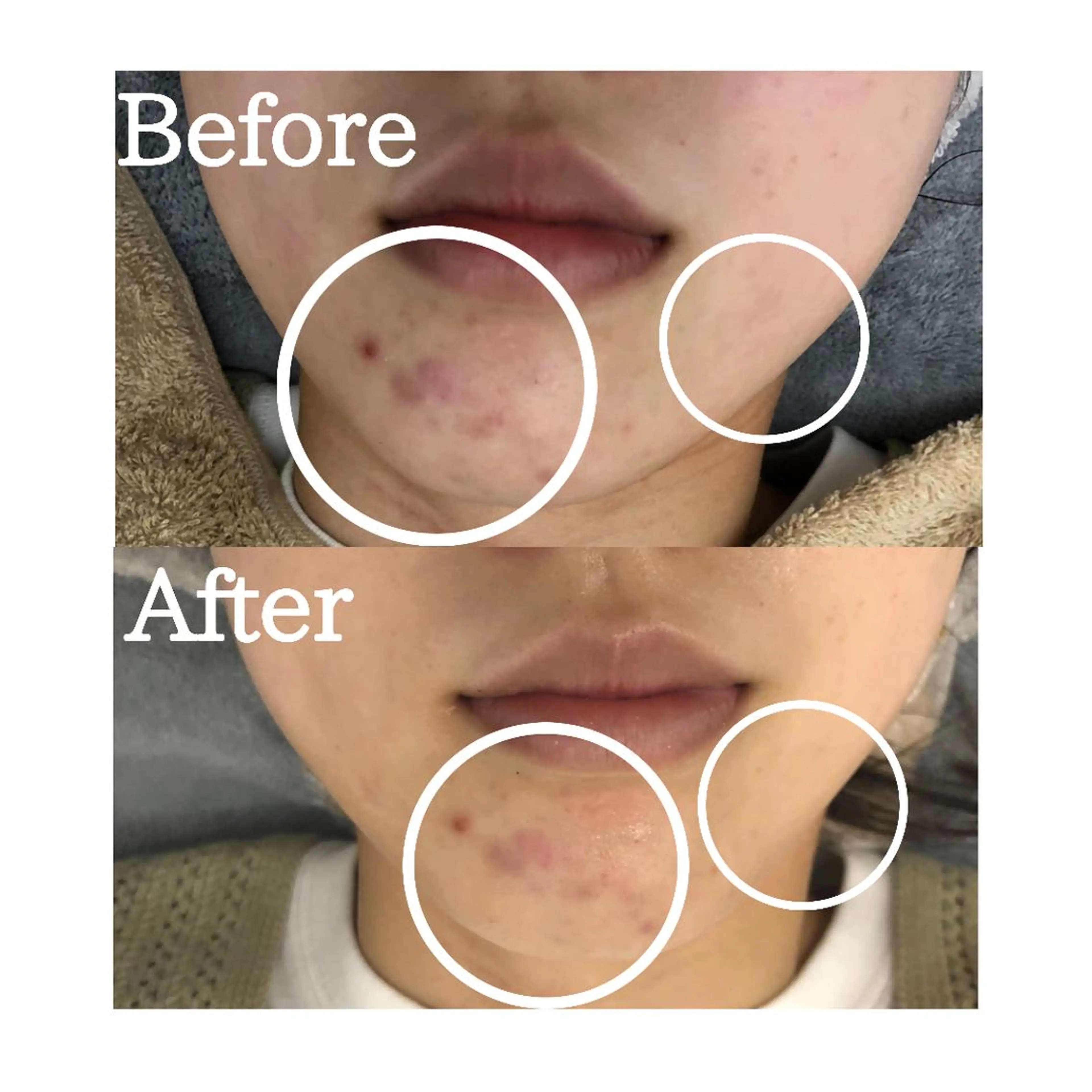 BestBelleꕤ 大阪福島/肌質改善のエステ・リラクイメージ