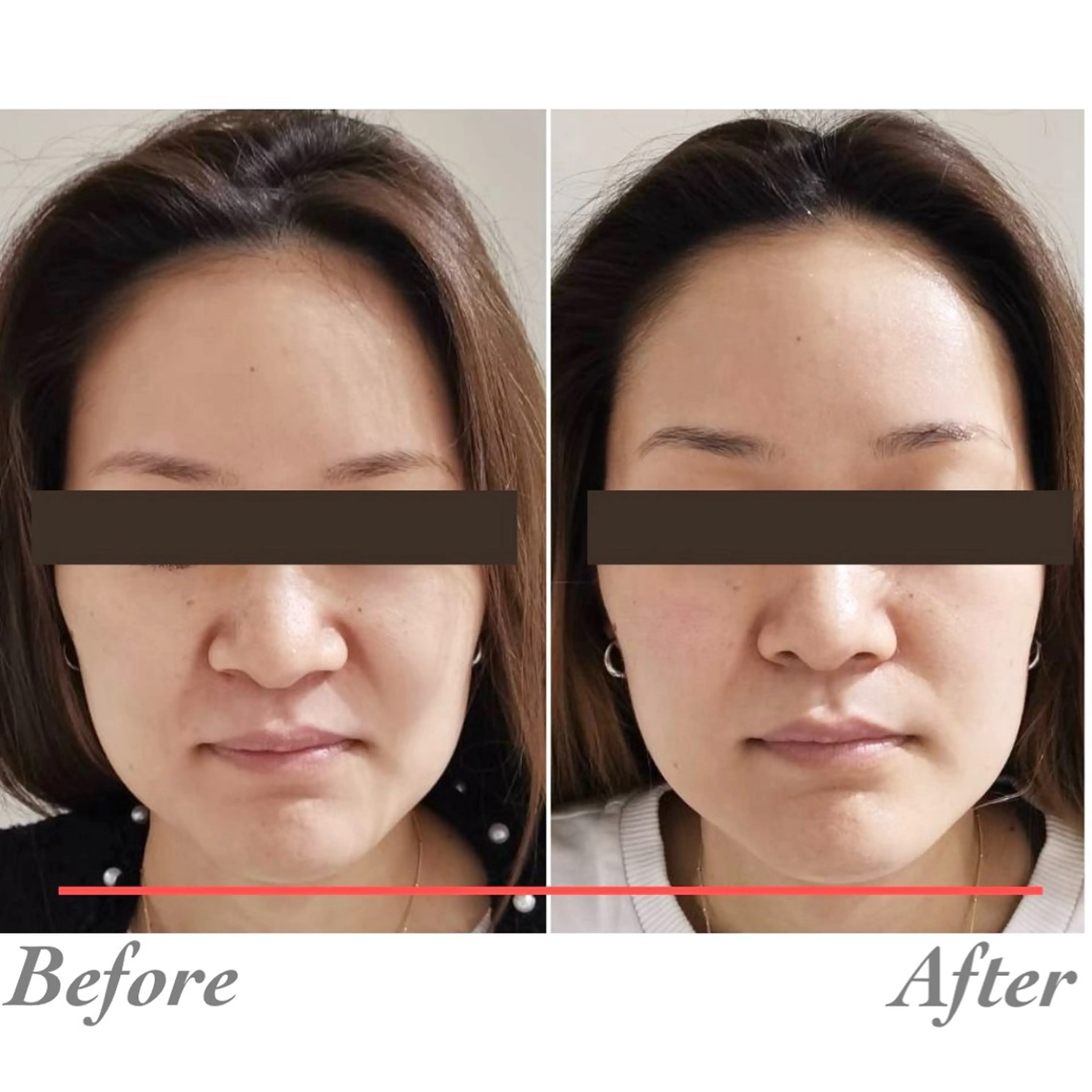 小顔・ツルツル素肌 ハリステリアのエステ・リラクイメージ