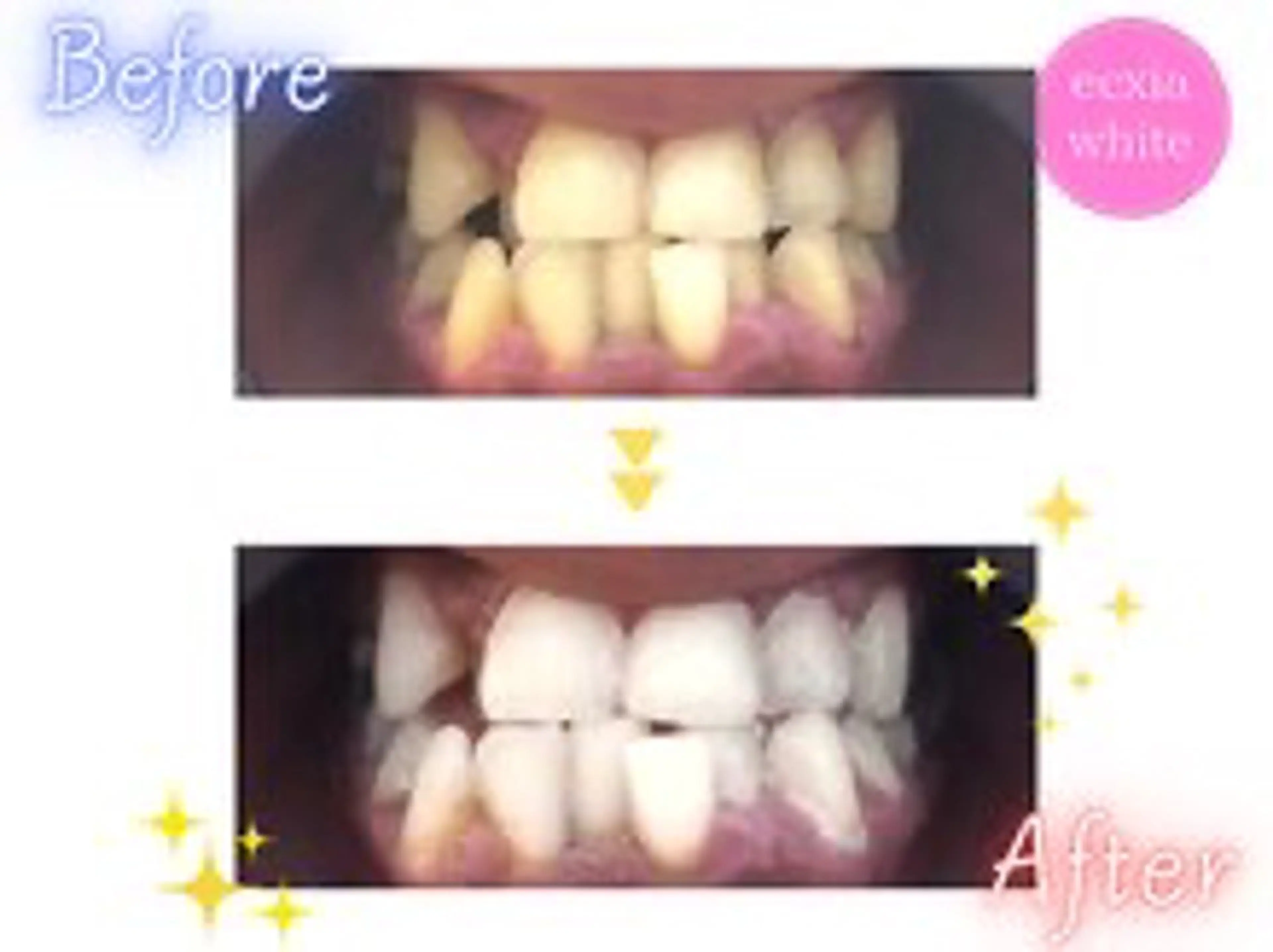 セルフホワイトニング エクシア 高田馬場のその他イメージ