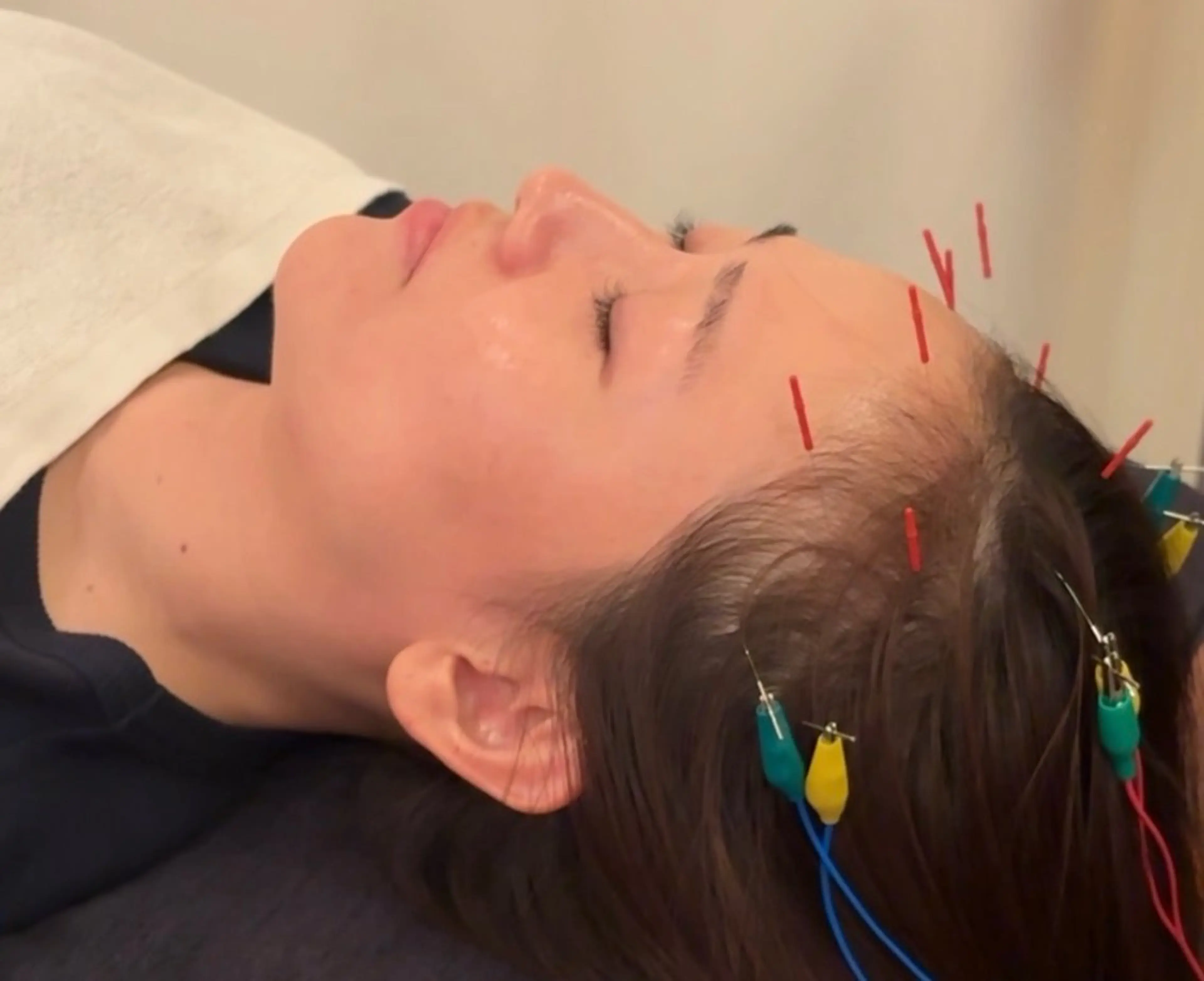 ミディアム メンズ 整体×美容鍼 ジェイペックのエステ・リラクイメージ